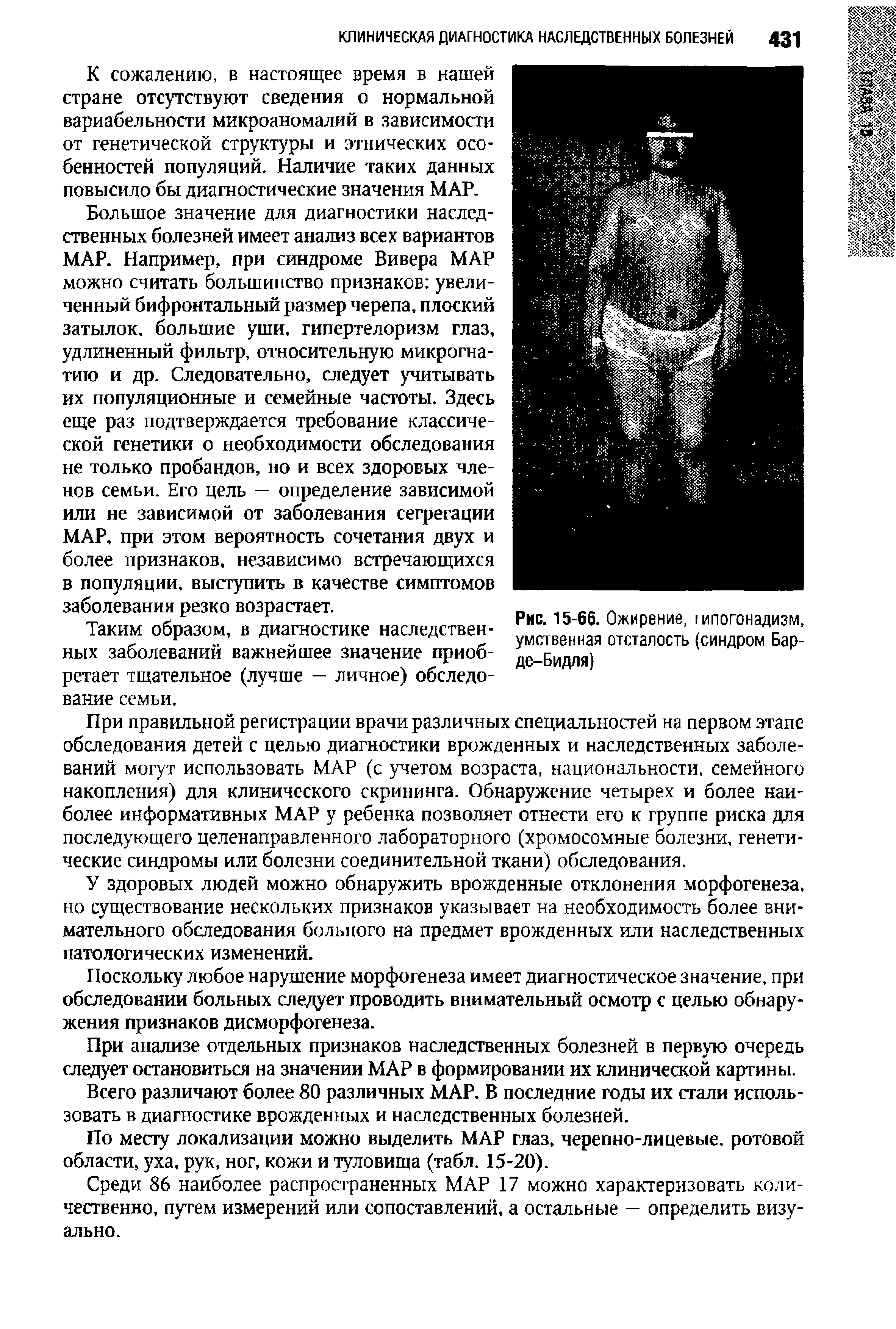 Рис. 15-66. Ожирение, гипогонадизм, умственная отсталость (синдром Барде- Бидля)...