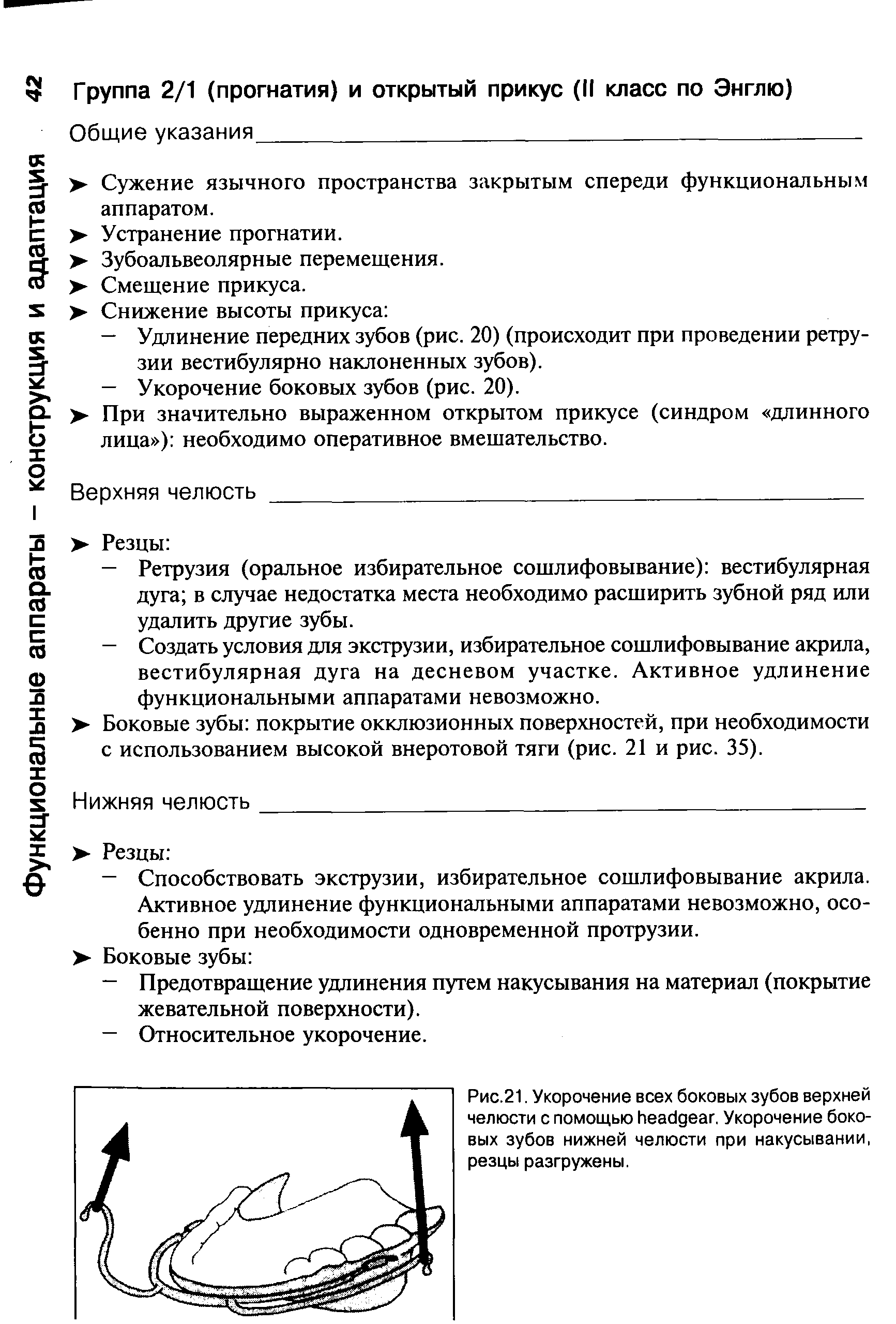 Рис.21. Укорочение всех боковых зубов верхней челюсти с помощью . Укорочение боковых зубов нижней челюсти при накусывании, резцы разгружены.