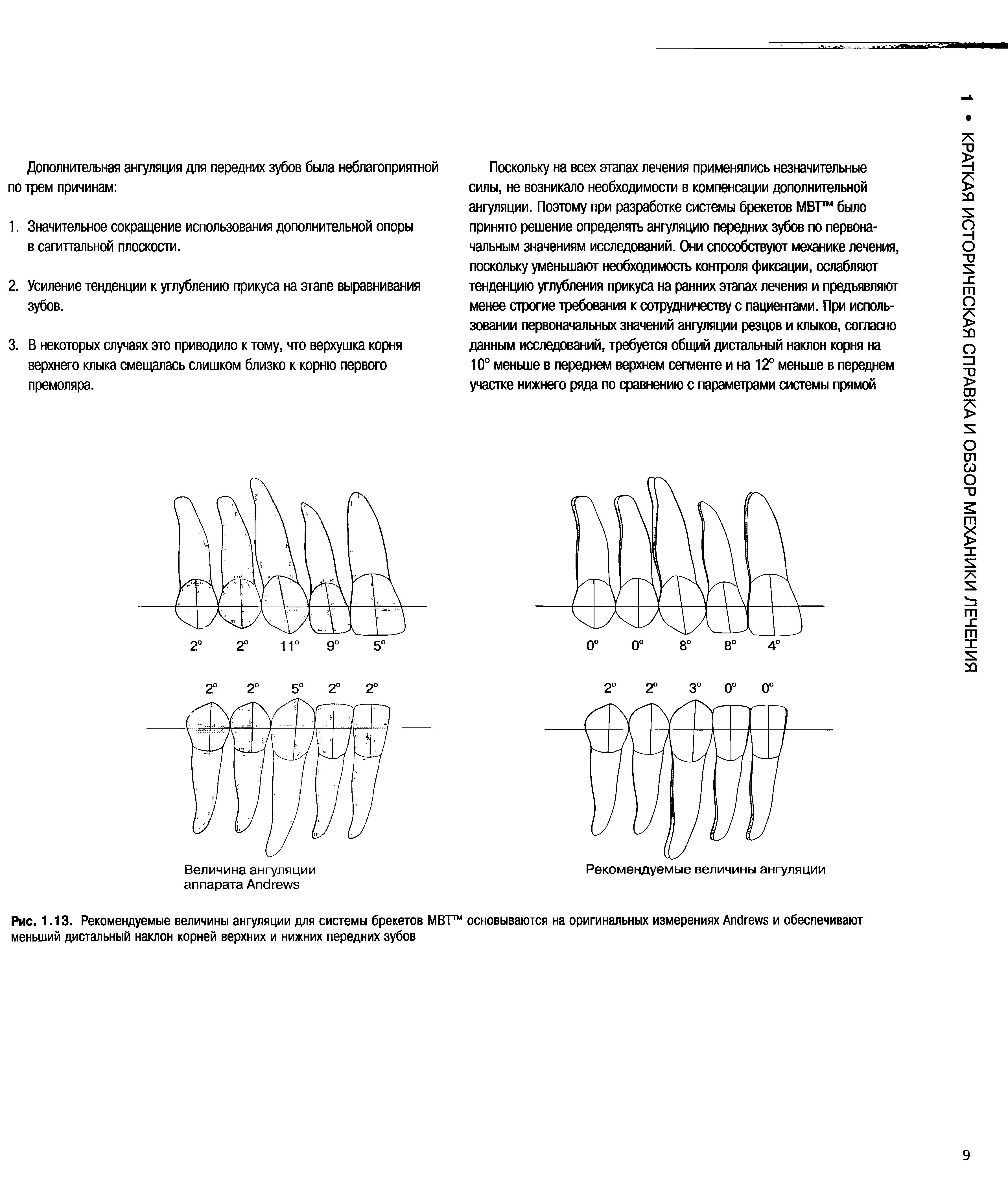Рис. 1.13. Рекомендуемые величины ангуляции для системы брекетов МВТ основываются на оригинальных измерениях A и обеспечивают меньший дистальный наклон корней верхних и нижних передних зубов...