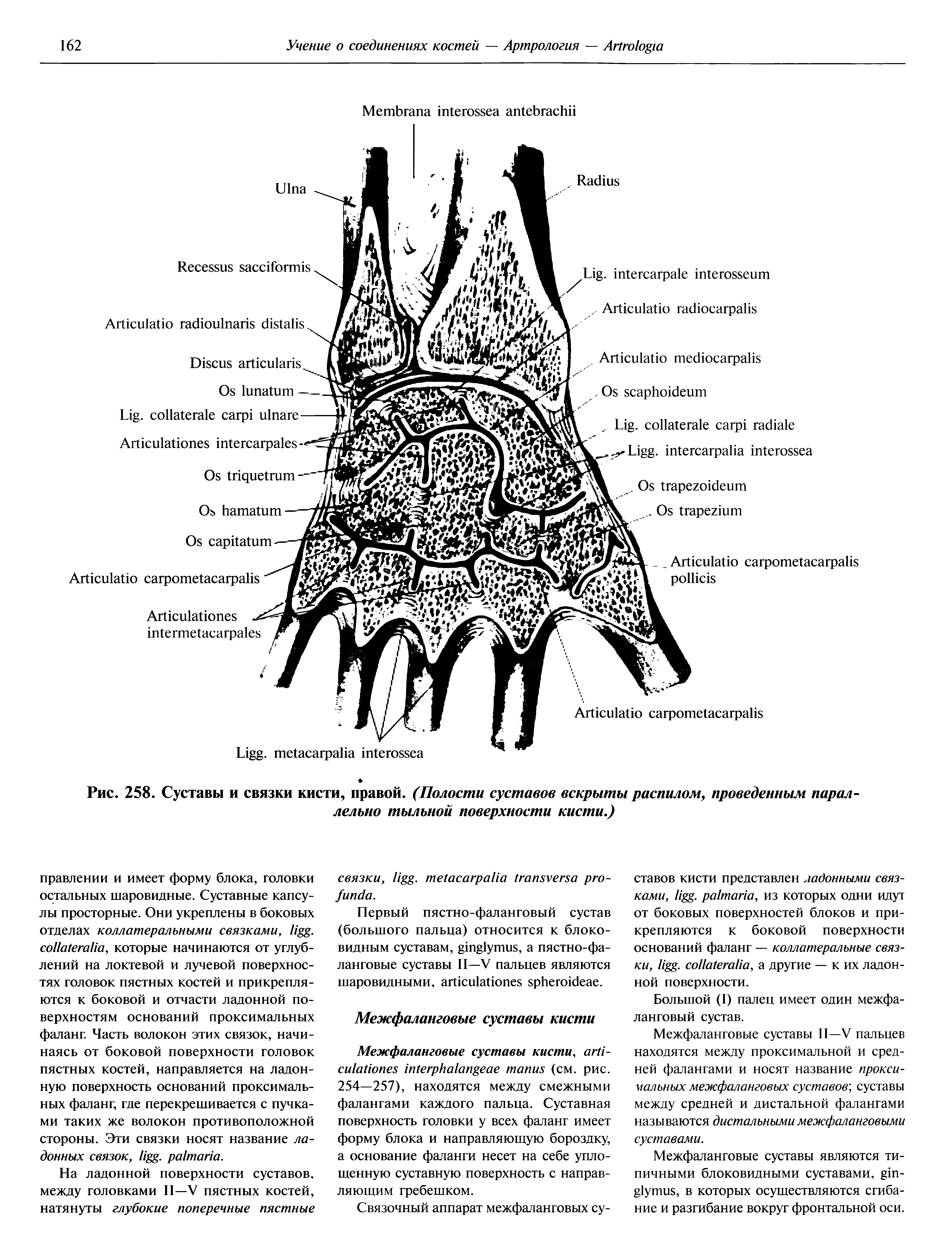 Рис. 258. Суставы и связки кисти, правой. (Полости суставов вскрыты распилом, проведенным параллельно тыльной поверхности кисти.)...