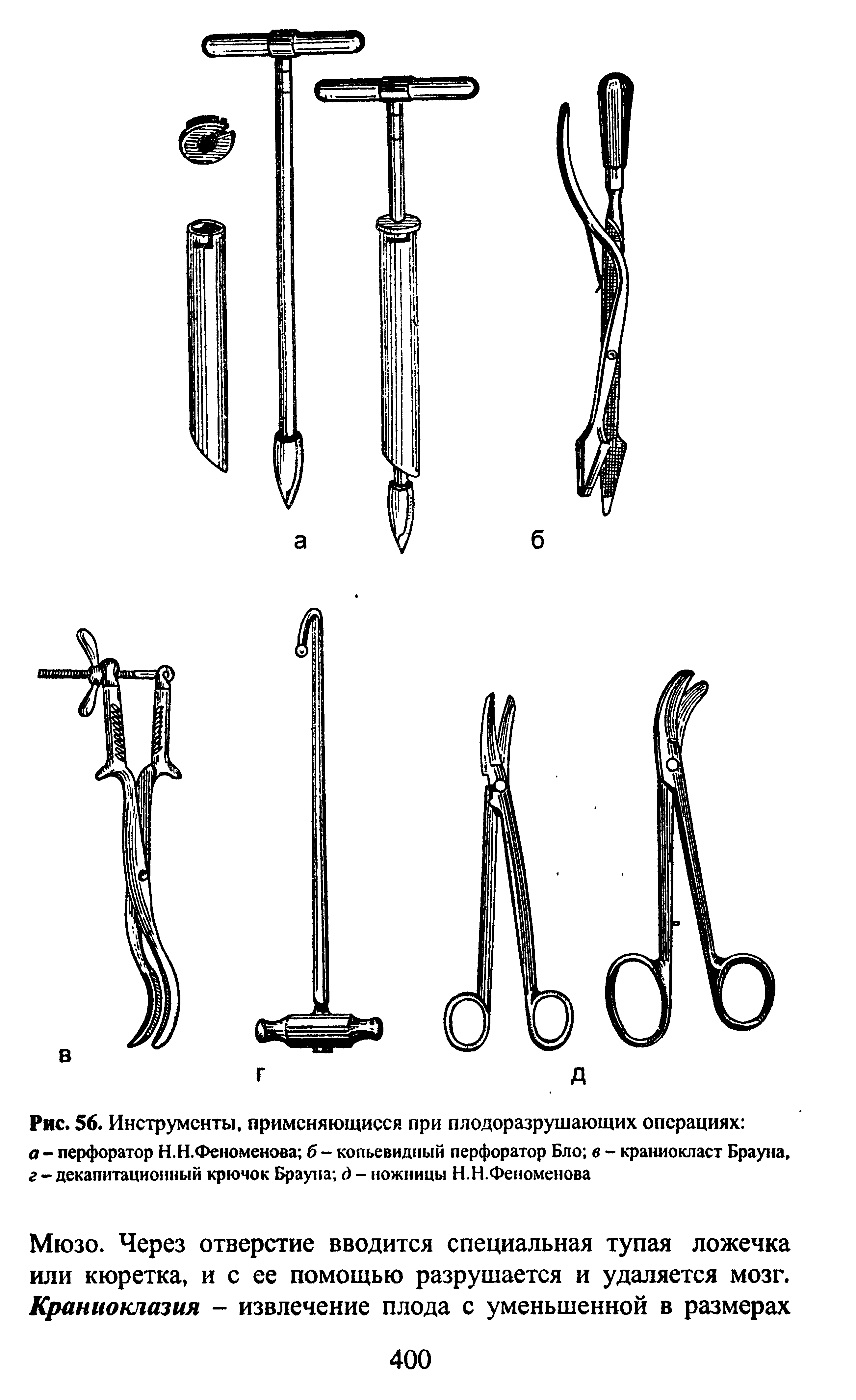 Рис. 56. Инструменты, применяющиеся при плодоразрушающих операциях а - перфоратор Н.Н.Феноменова б - копьевидный перфоратор Бло в - краниокласт Брауна. г - декапитационный крючок Брауна д - ножницы Н.Н.Феноменова...