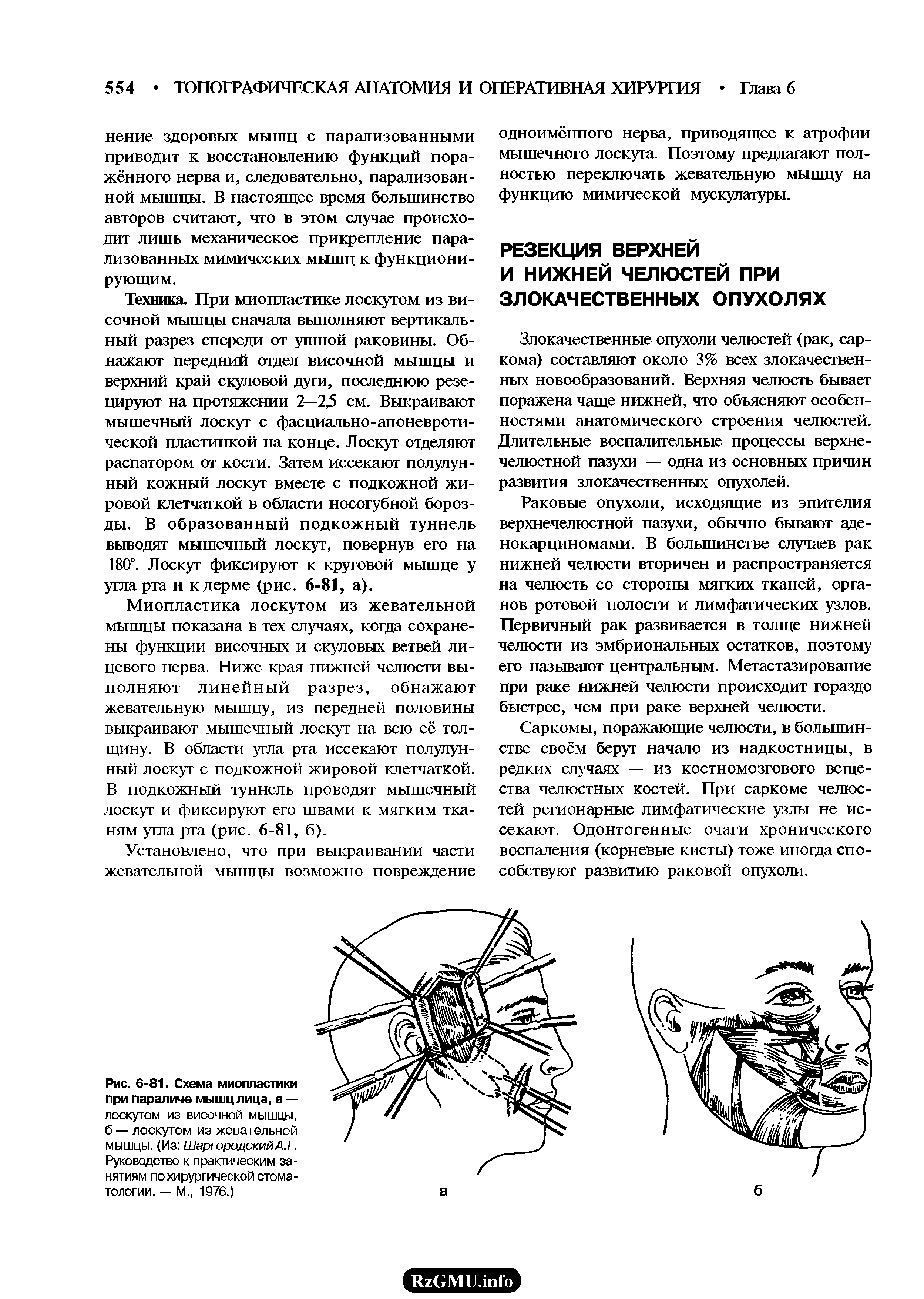 Рис. 6-81. Схема миопластики при параличе мышц лица, а — лоскутом из височной мышцы, б — лоскутом из жевательной мышцы. (Из ШаргородскийА.Г. Руководство к практическим занятиям по хирургической стоматологии. — М., 1976.)...