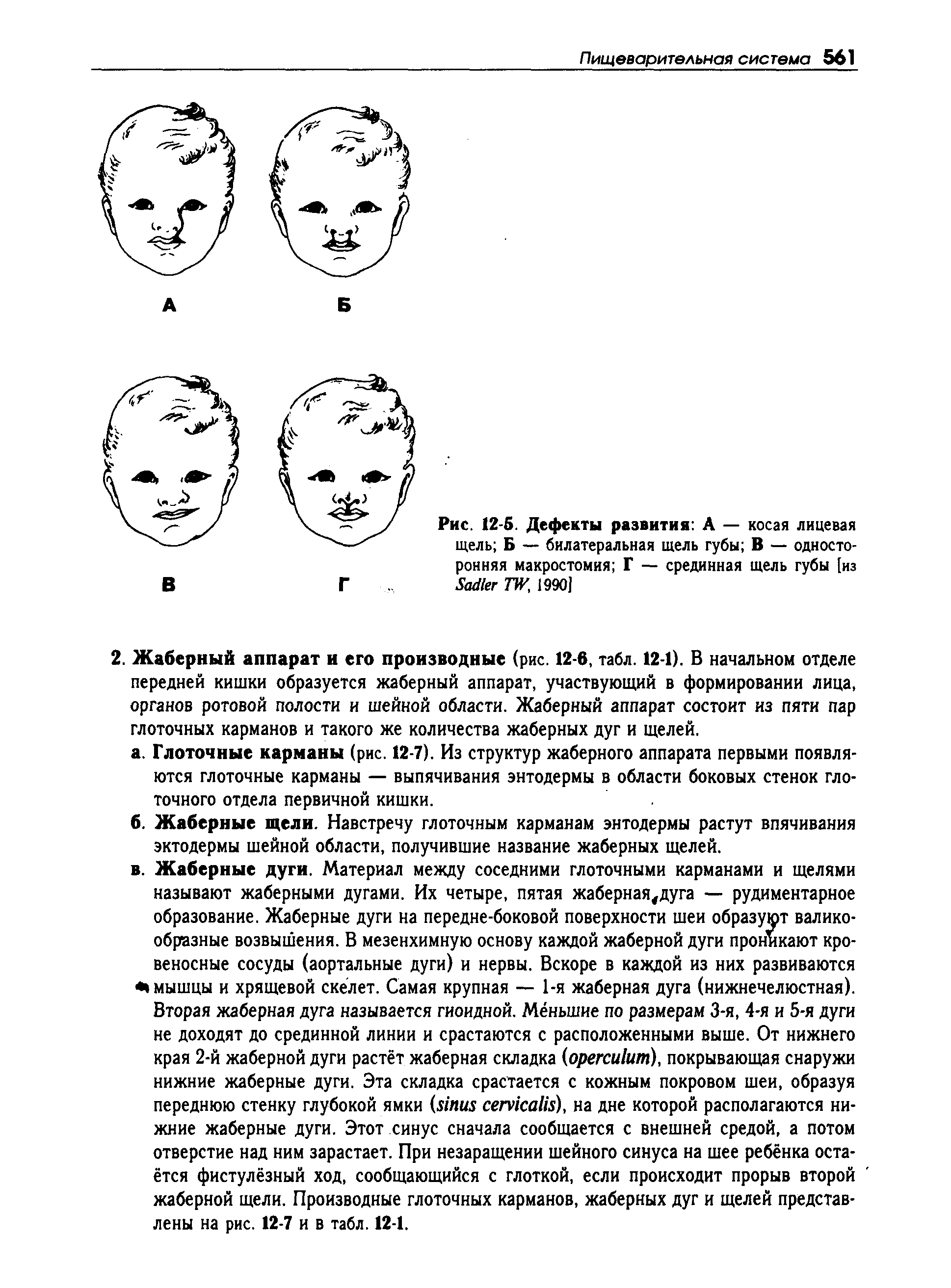 Рис. 12-5. Дефекты развития А — косая лицевая щель Б — билатеральная щель губы В — односторонняя макростомия Г — срединная щель губы [из S TW, 1990]...