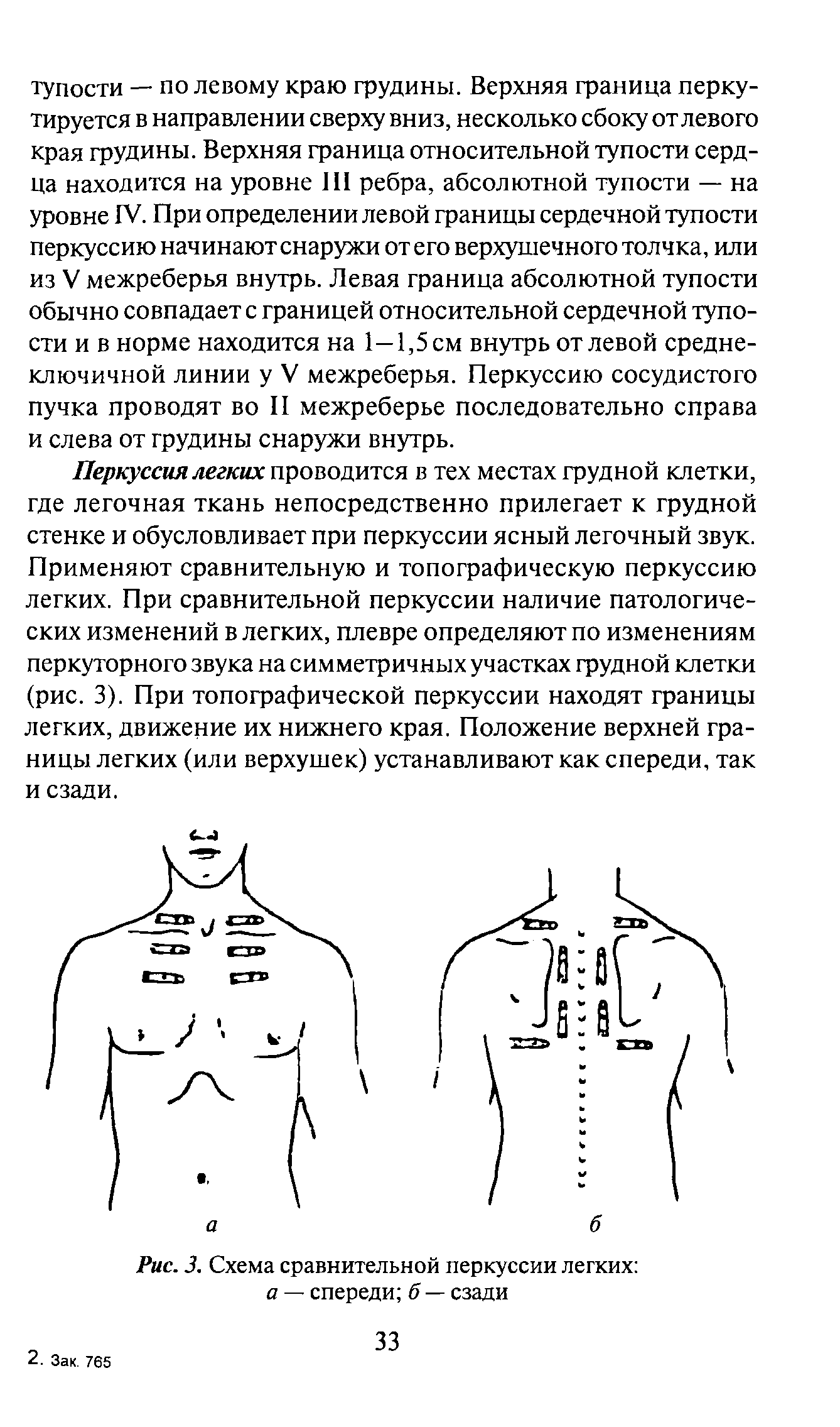 Рис. 3. Схема сравнительной перкуссии легких а — спереди б — сзади...