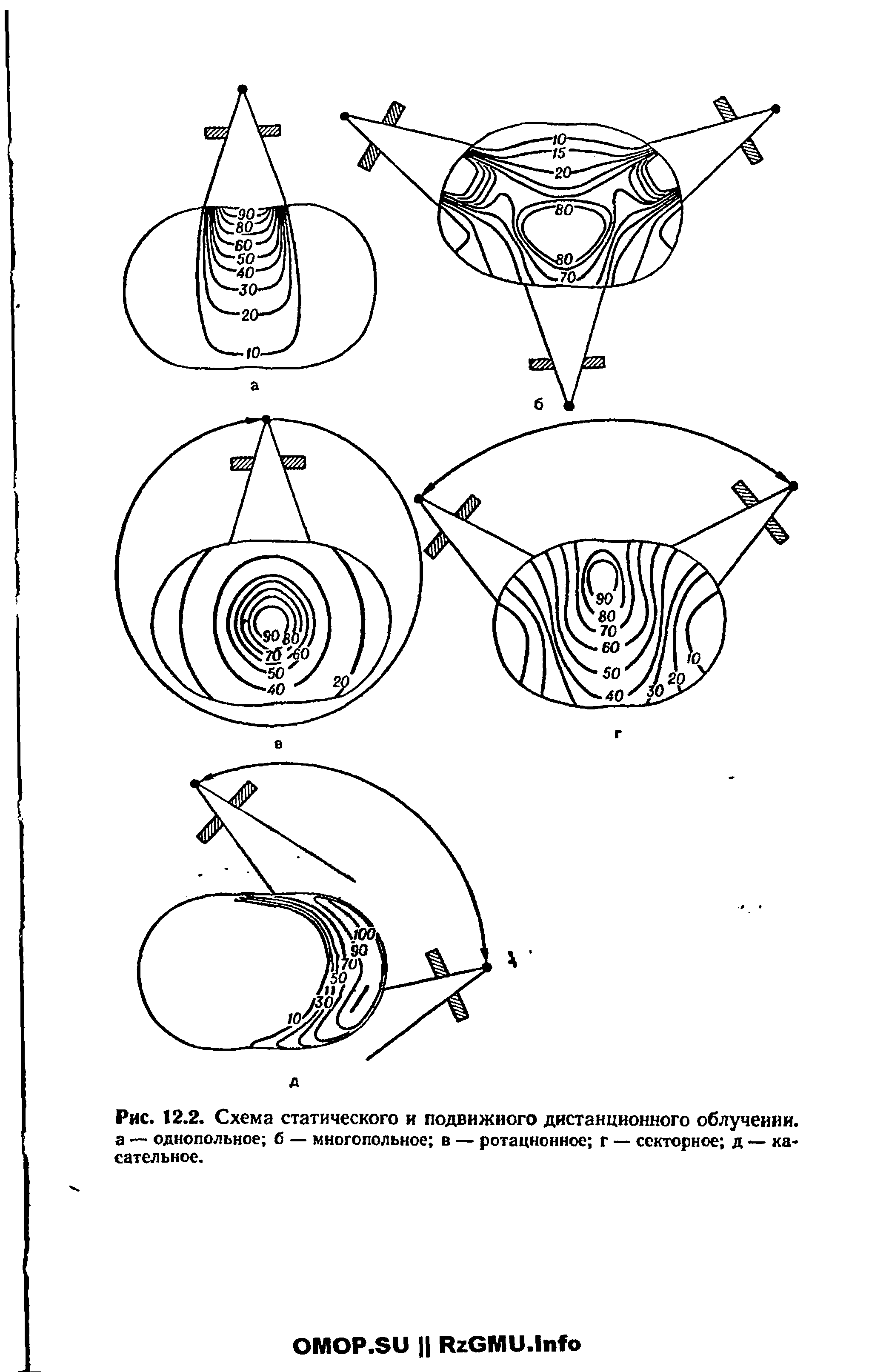 Рис. 12.2. Схема статического и подвижного дистанционного облучении, а — однопольное б — многопольное в — ротационное г — секторное д — касательное.