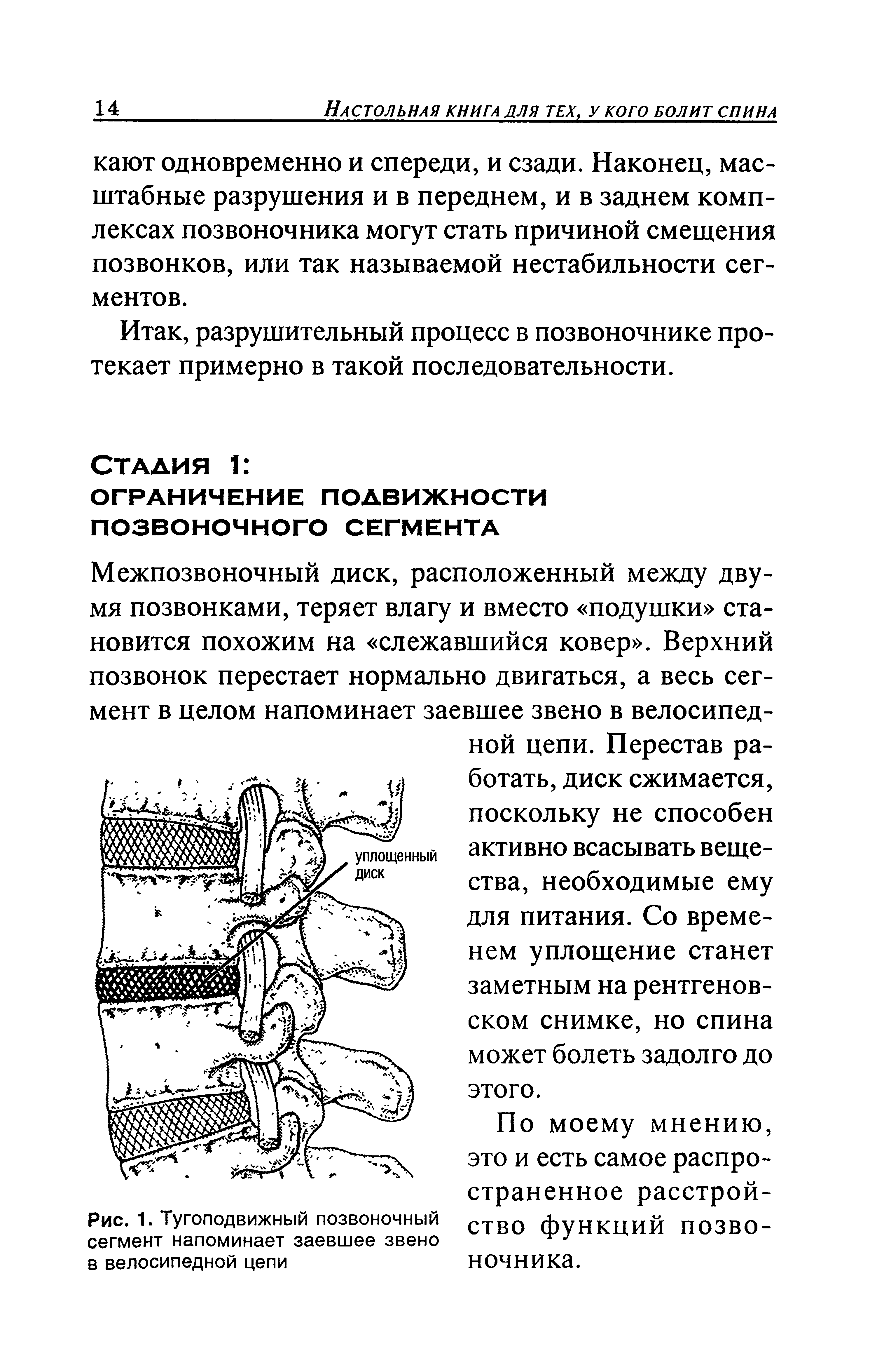 Рис. 1. Тугоподвижный позвоночный сегмент напоминает заевшее звено в велосипедной цепи...