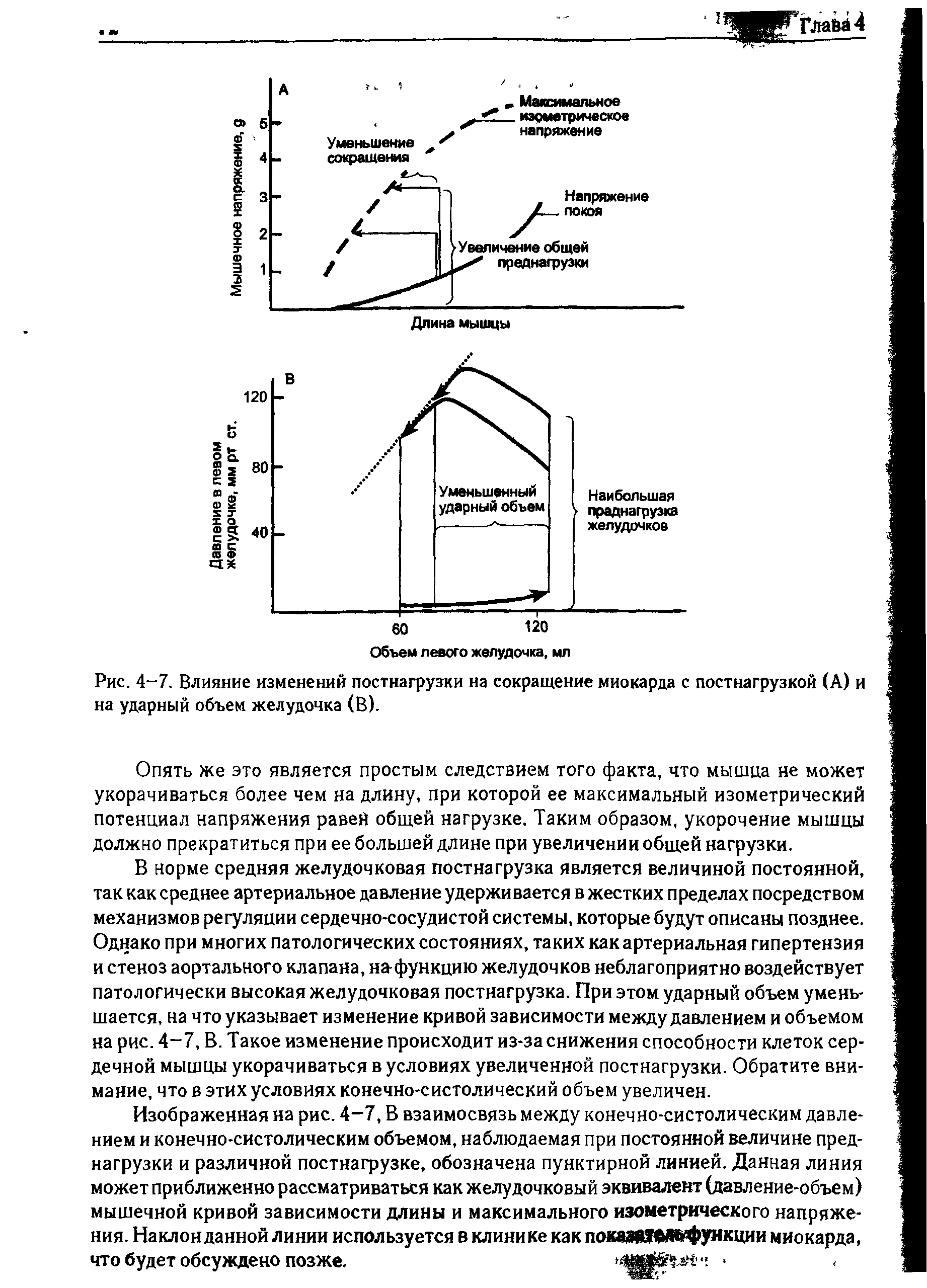 Рис. 4-7. Влияние изменений постнагрузки на сокращение миокарда с постнагрузкой (А) и на ударный объем желудочка (В).
