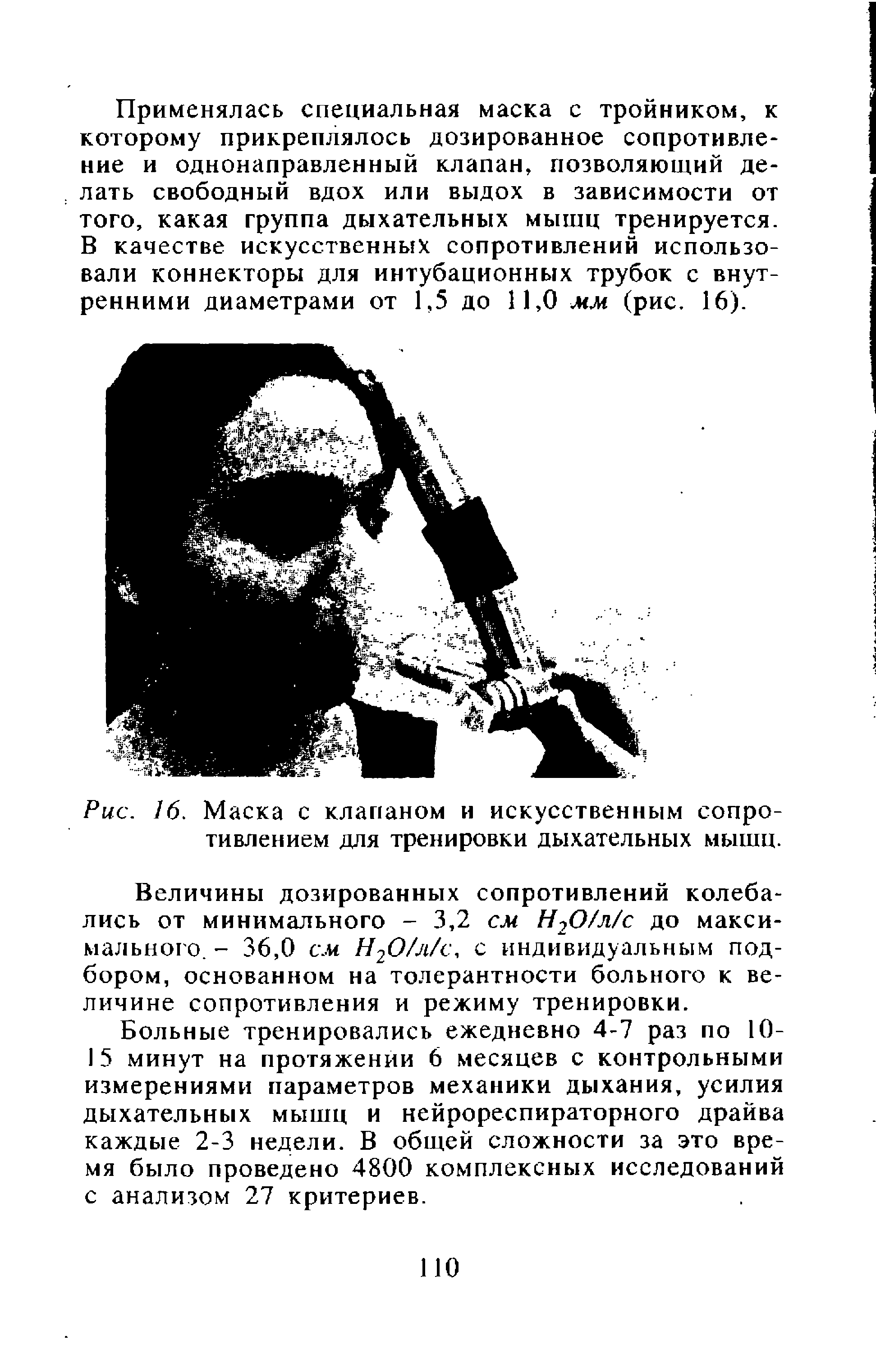 Рис. 16. Маска с клапаном и искусственным сопротивлением для тренировки дыхательных мышц.