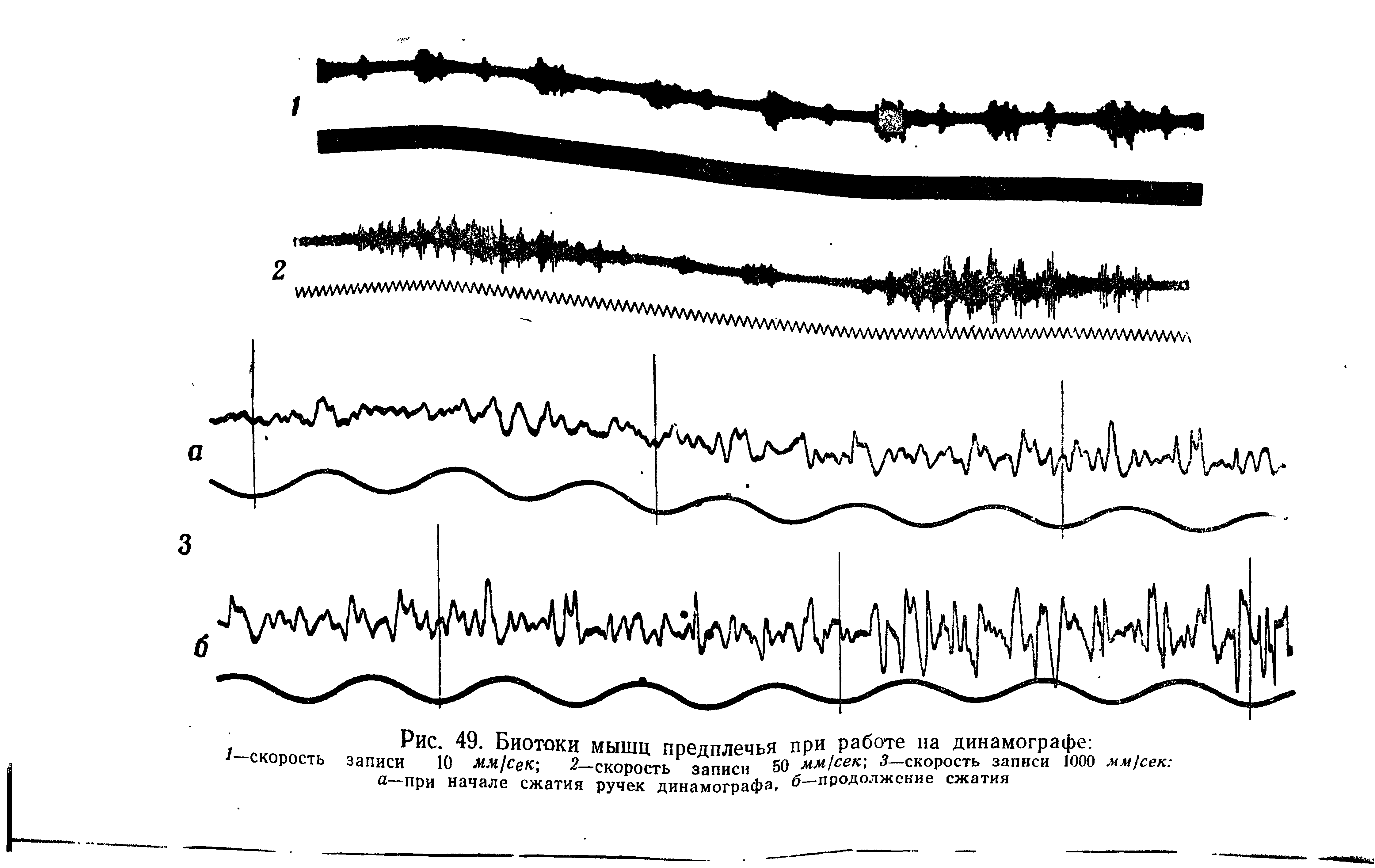 Рис. 49. Биотоки мышц предплечья записи 10 мм сек —скорость записи 50 а—при начале сжатия ручек динамографа.