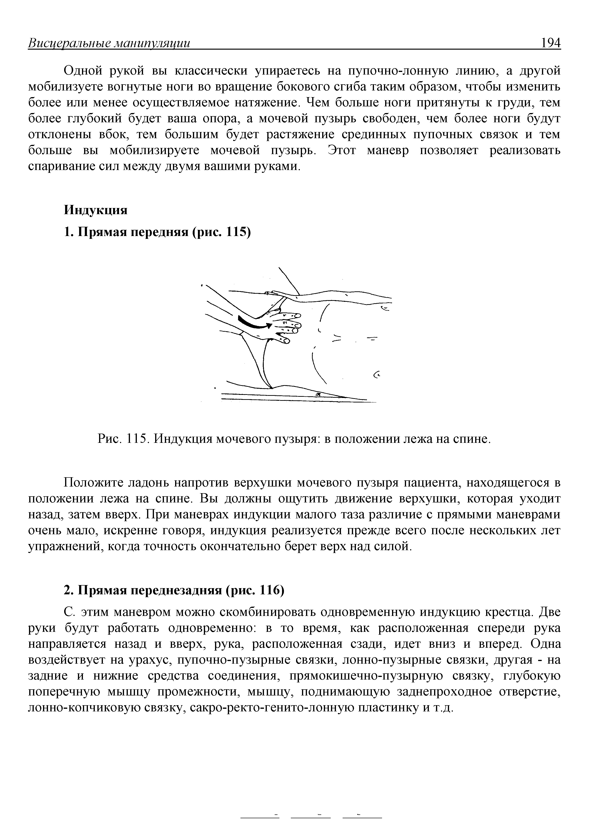 Рис. 115. Индукция мочевого пузыря в положении лежа на спине.