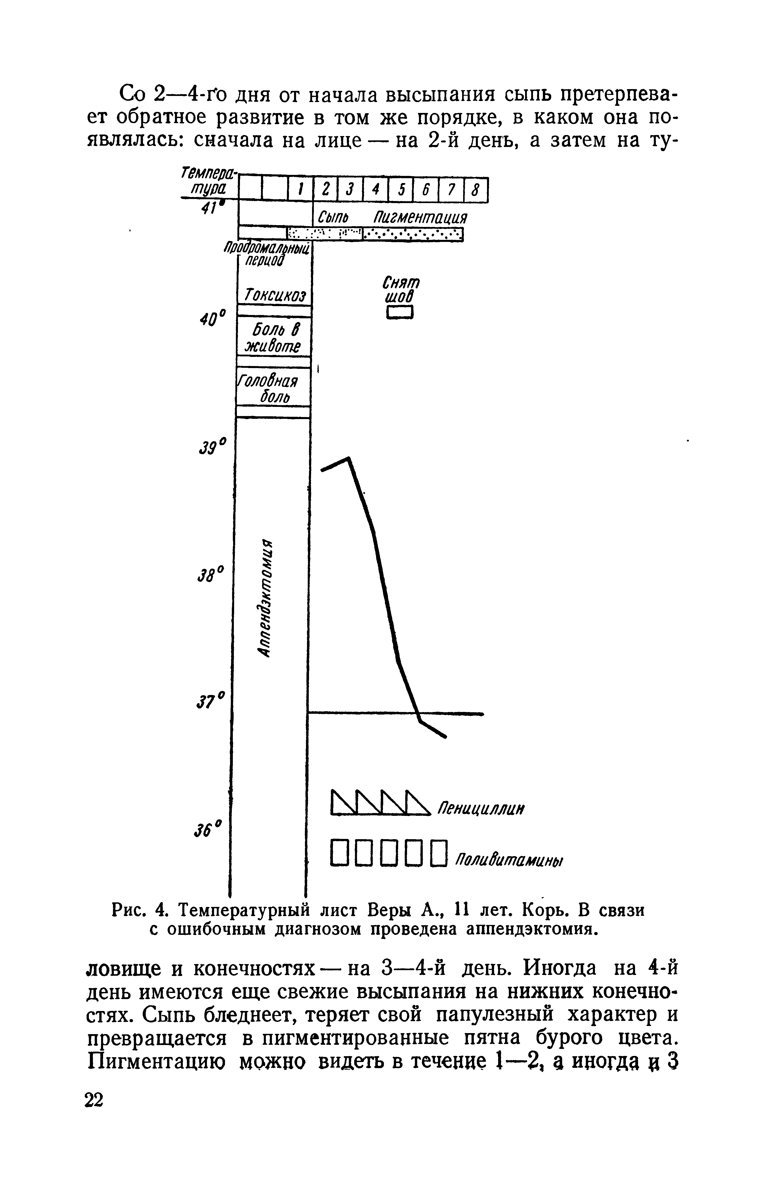 Рис. 4. Температурный лист Веры А., 11 лет. Корь. В связи с ошибочным диагнозом проведена аппендэктомия.