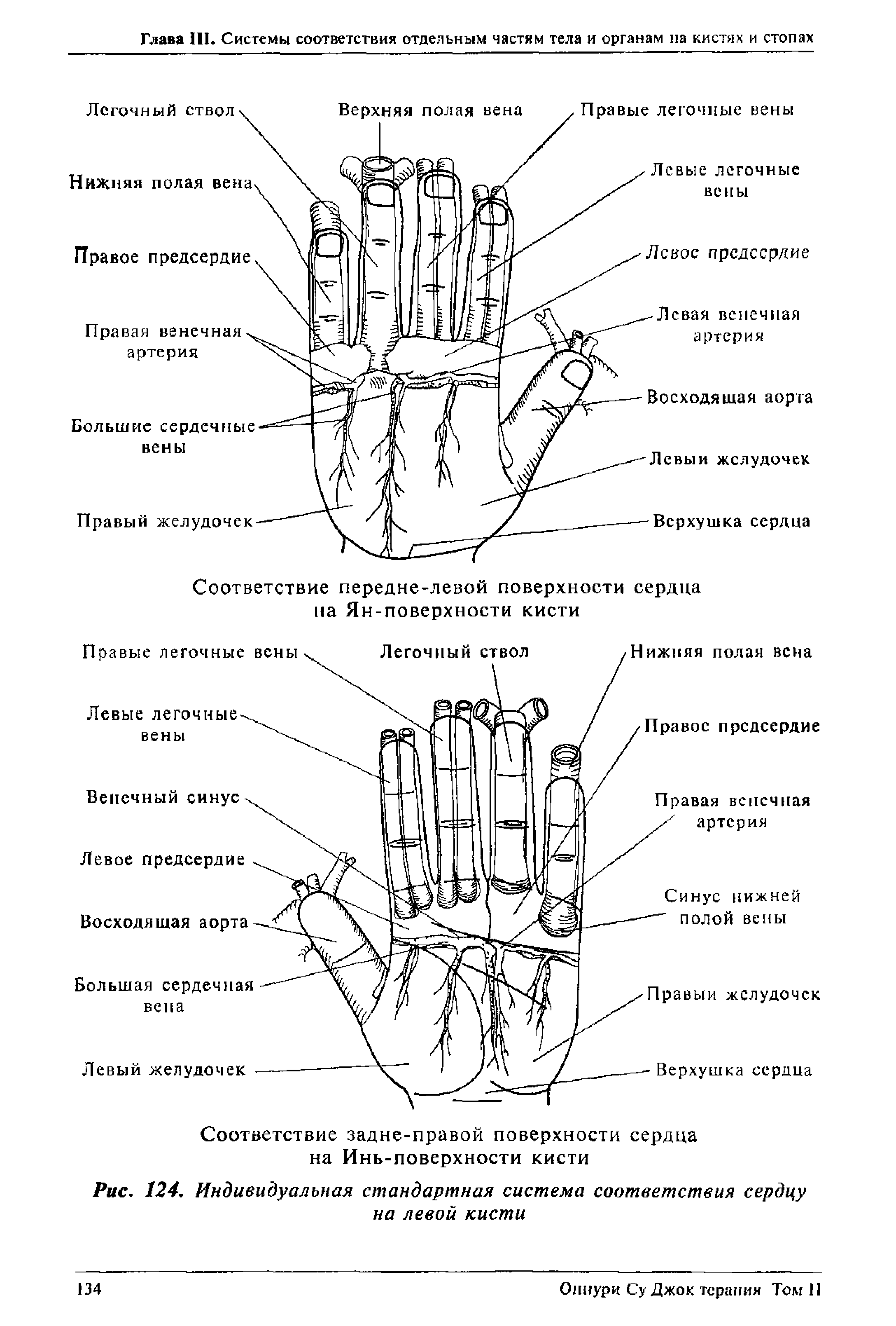 Рис. 124. Индивидуальная стандартная система соответствия сердцу на левой кисти...