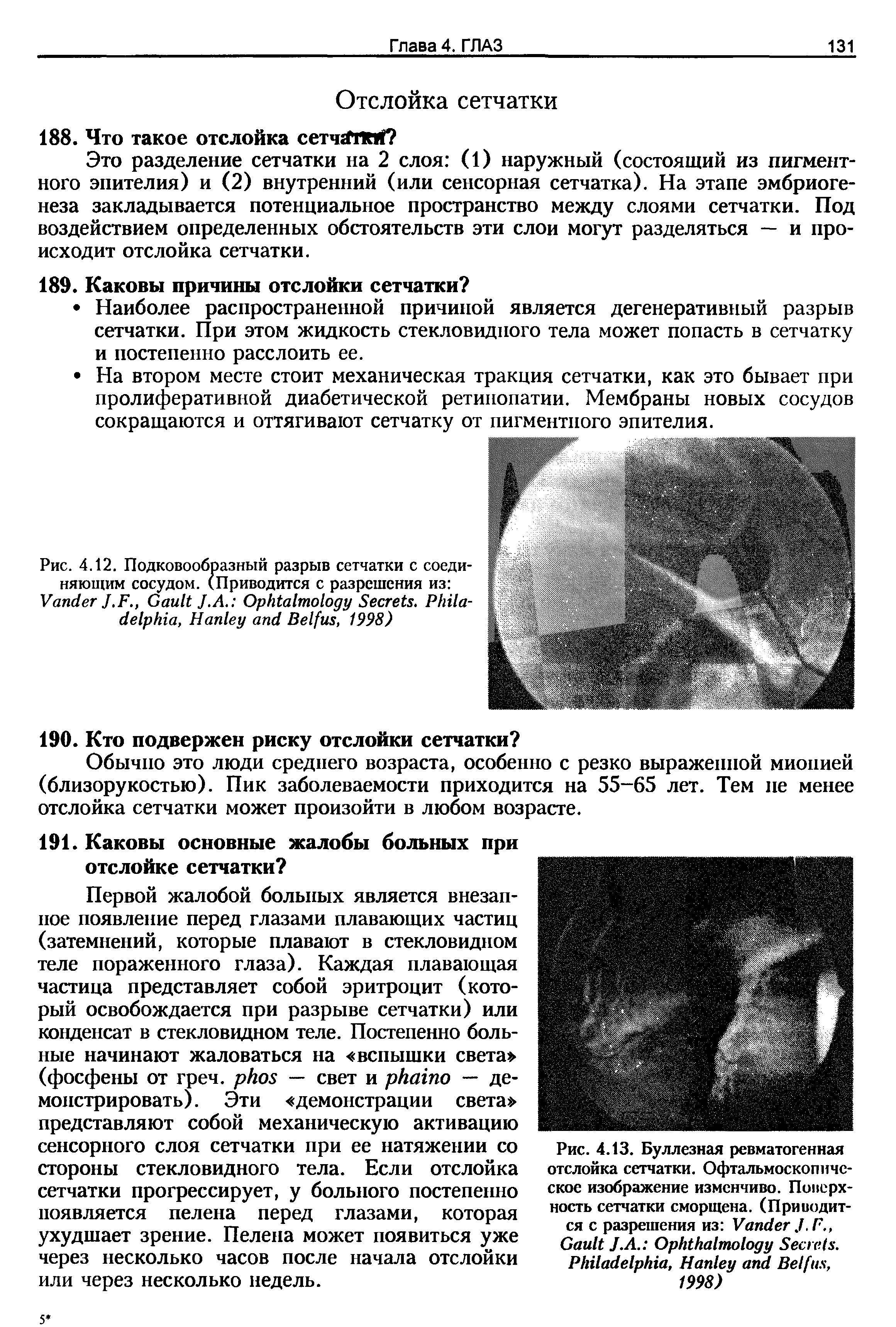 Рис. 4.12. Подковообразный разрыв сетчатки с соединяющим сосудом. (Приводится с разрешения из ...