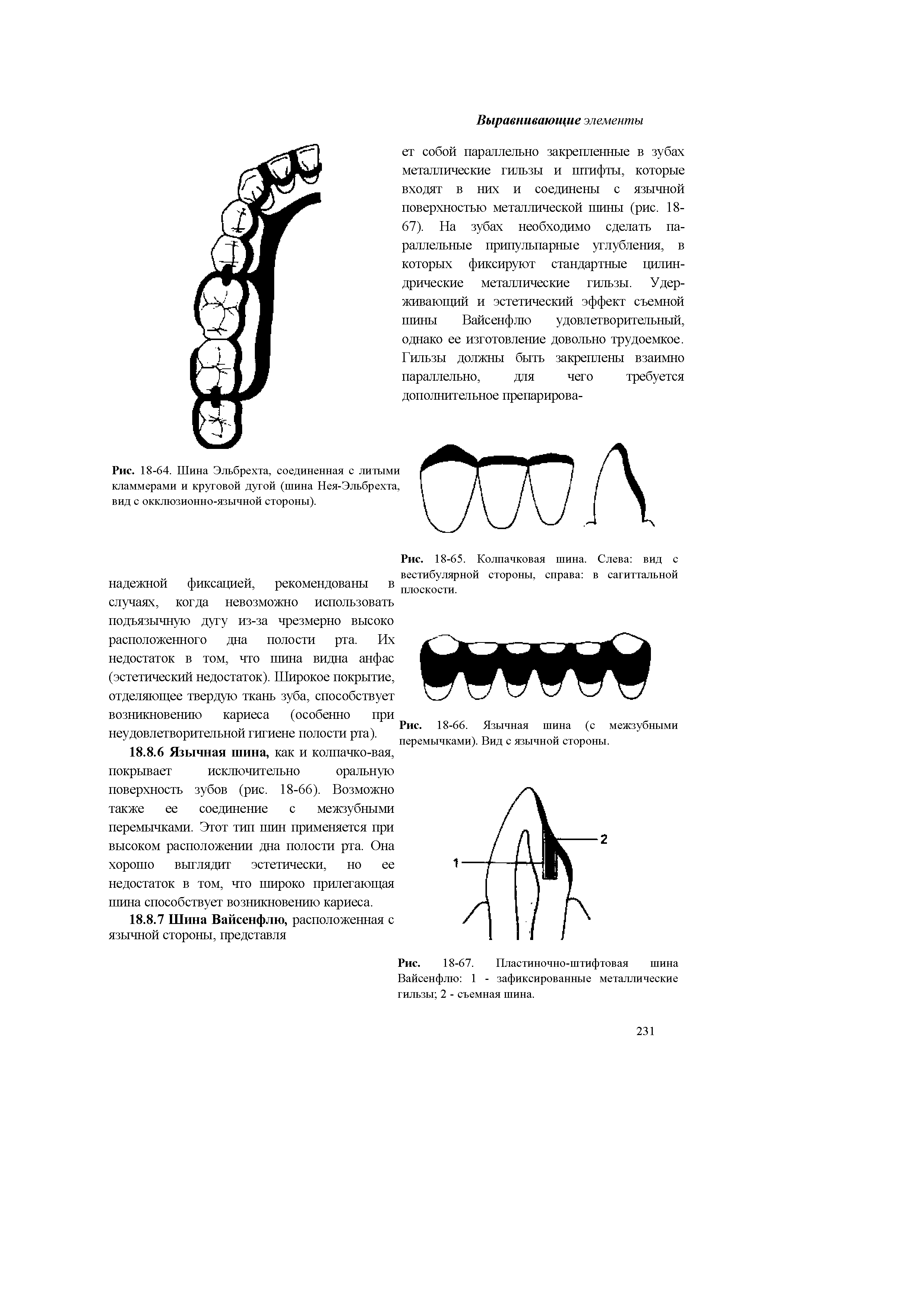 Рис. 18-66. Язычная шина (с межзубными перемычками). Вид с язычной стороны.