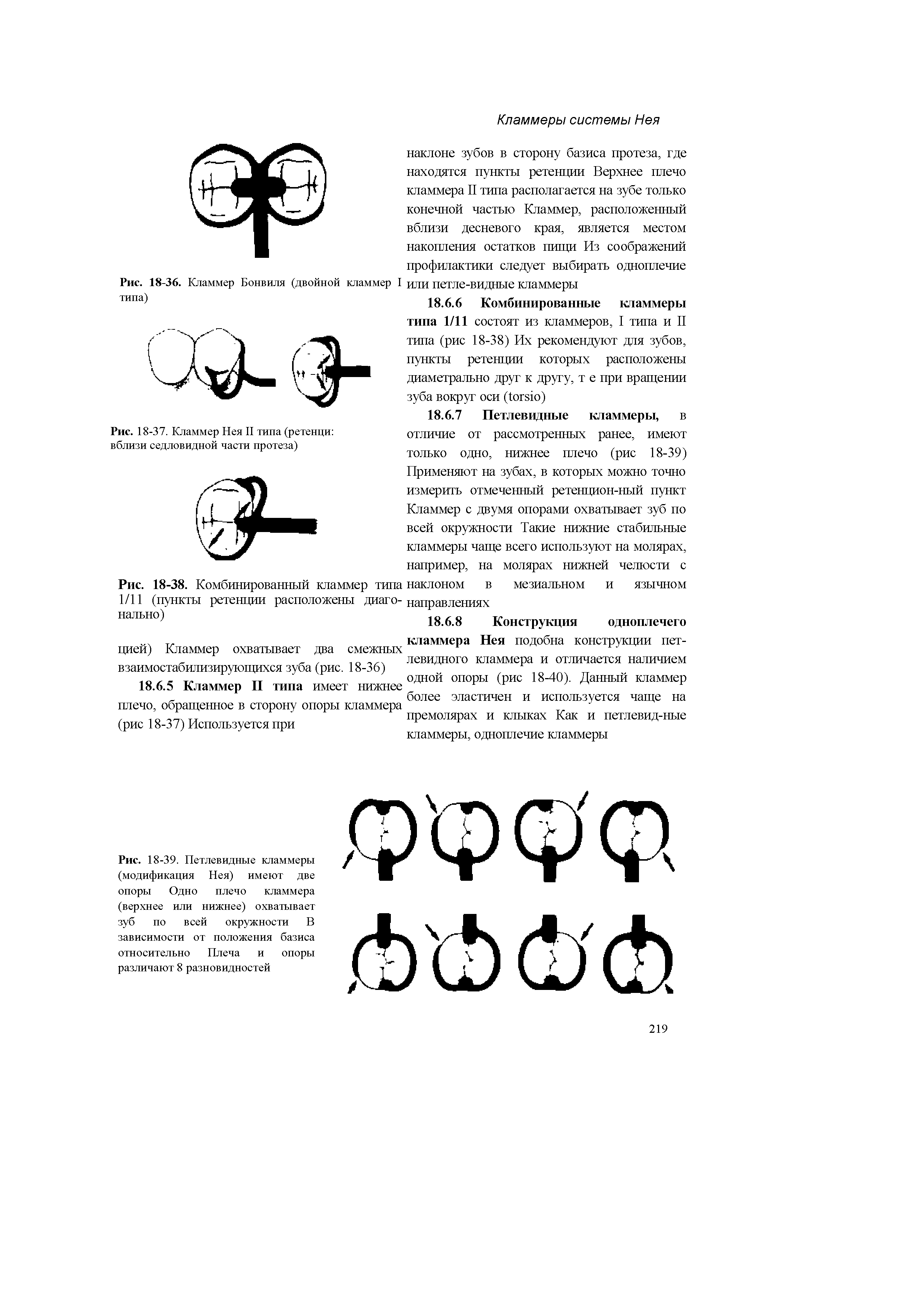 Рис. 18-37. Кламмер Нея II типа (ретенци вблизи седловидной части протеза)...
