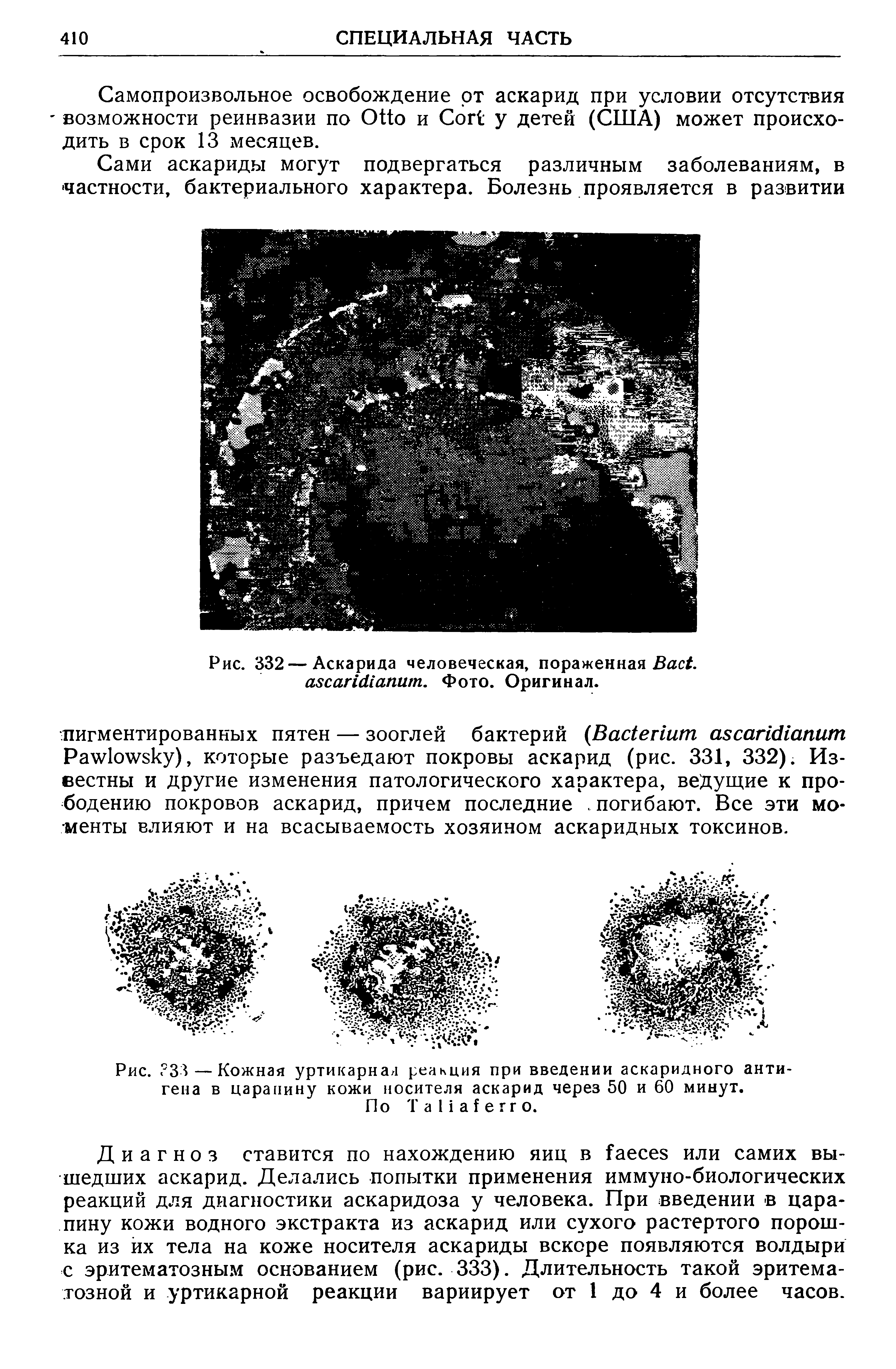 Рис. 332 — Аскарида человеческая, пораженная B . . Фото. Оригинал.