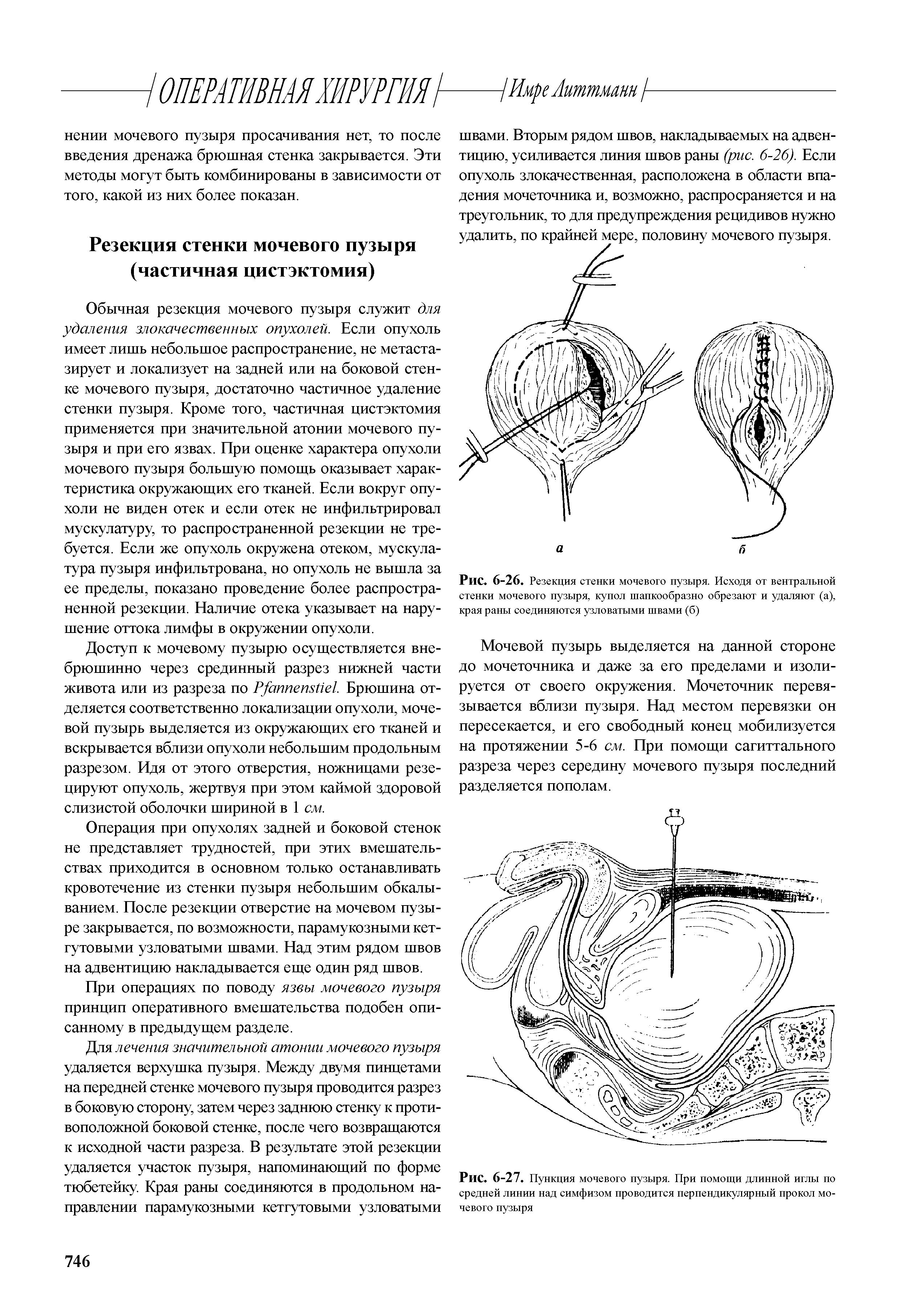 Рис. 6-26. Резекция стенки мочевого пузыря. Исходя от вентральной стенки мочевого пузыря, купол шапкообразно обрезают и удаляют (а), края раны соединяются узловатыми швами (б)...