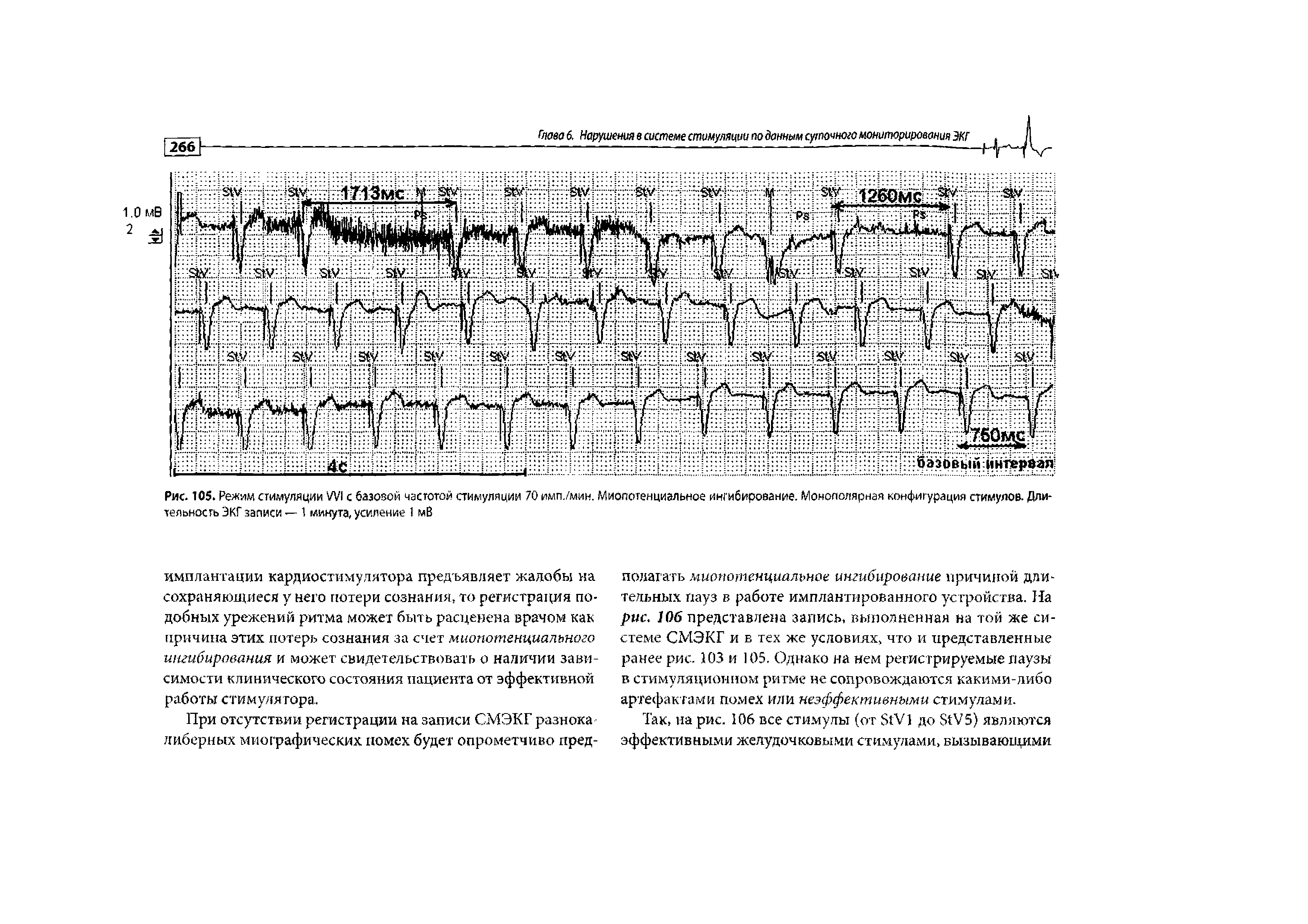 Рис. 105. Режим стимуляции WI с базовой частотой стимуляции 70 имп./мин. Миопотенциальное ингибирование. Монополярная конфигурация стимулов. Длительность ЭКГ записи — 1 минута, усиление 1 мВ...