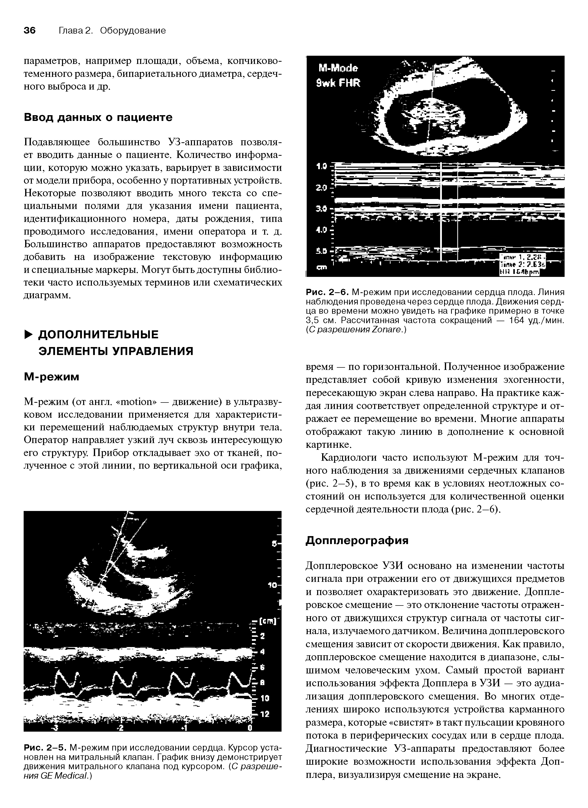 Рис. 2-6. М-режим при исследовании сердца плода. Линия наблюдения проведена через сердце плода. Движения сердца во времени можно увидеть на графике примерно в точке 3,5 см. Рассчитанная частота сокращений — 164 уд./мин. (С разрешения Z .)...