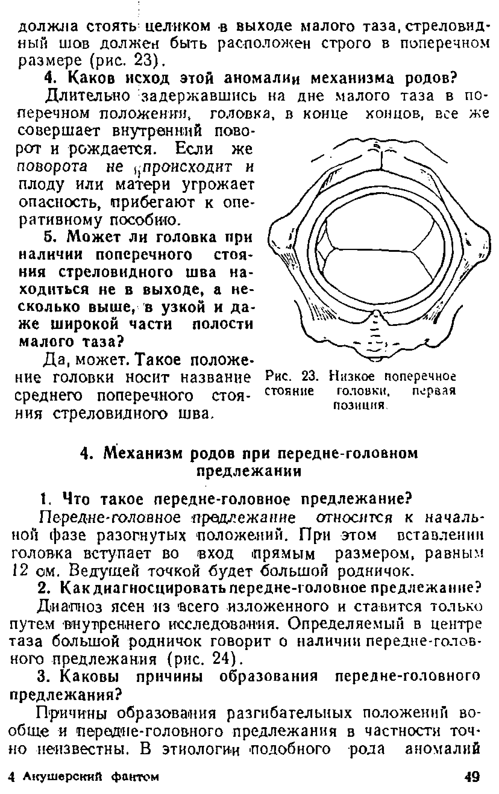 Рис. 23. Низкое поперечное стояние головки. первая позиция...