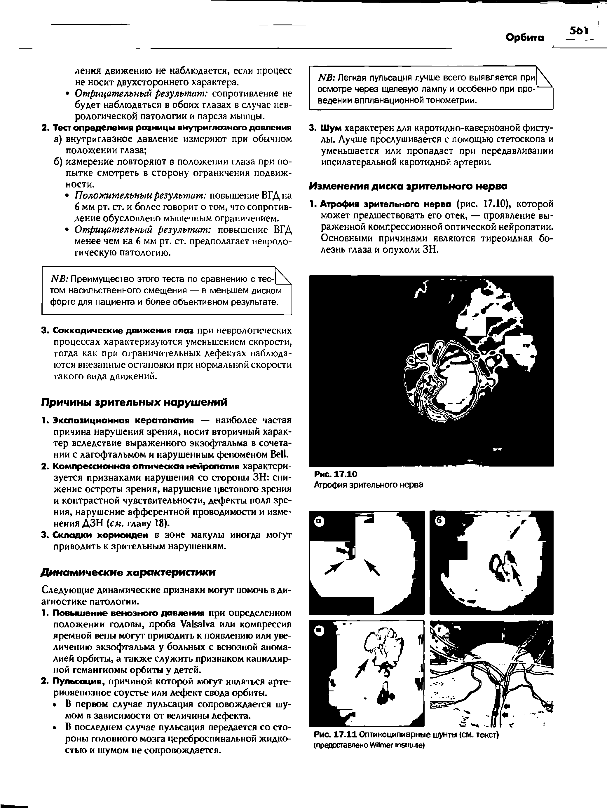 Рис. 17.11 Оптикоцилиарные шунты (см. текст) (предоставлено W I )...