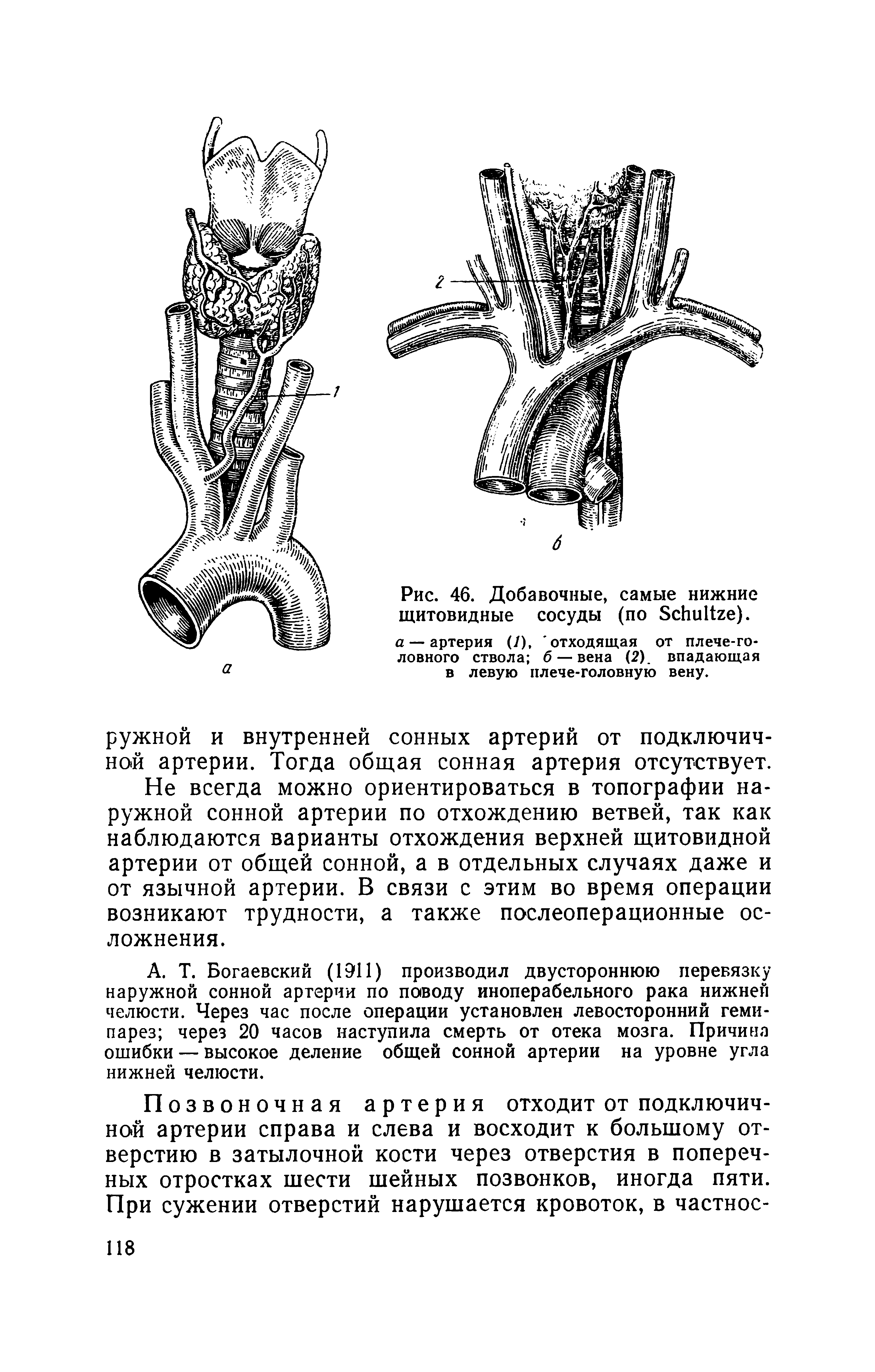 Рис. 46. Добавочные, самые нижние щитовидные сосуды (по S ). а — артерия (/), отходящая от плече-головного ствола б — вена (2). впадающая в левую плече-головную вену.