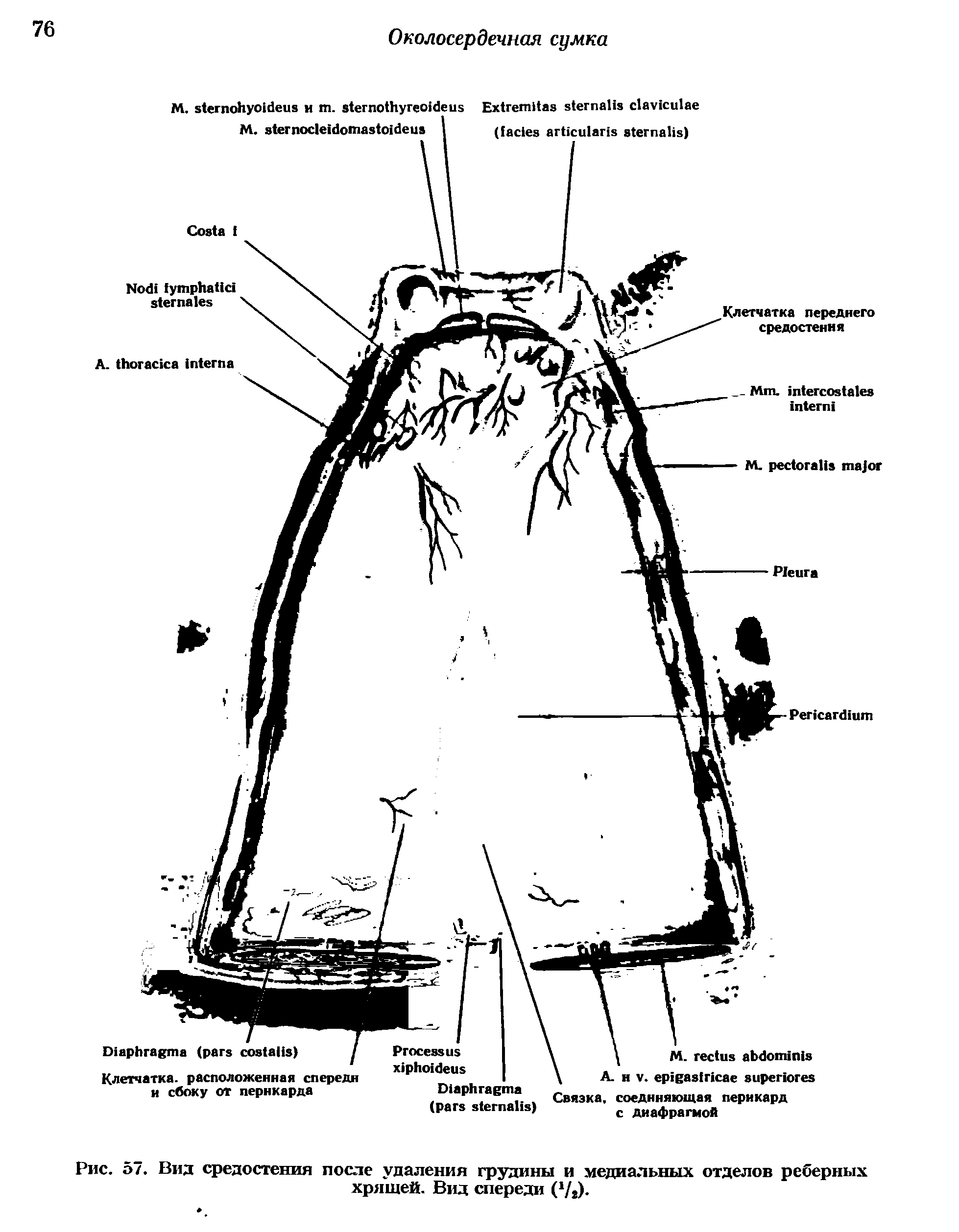 Рис. 57. Вид средостения после удаления грудины и медиальных отделов реберных хрящей. Вид спереди ( /2).