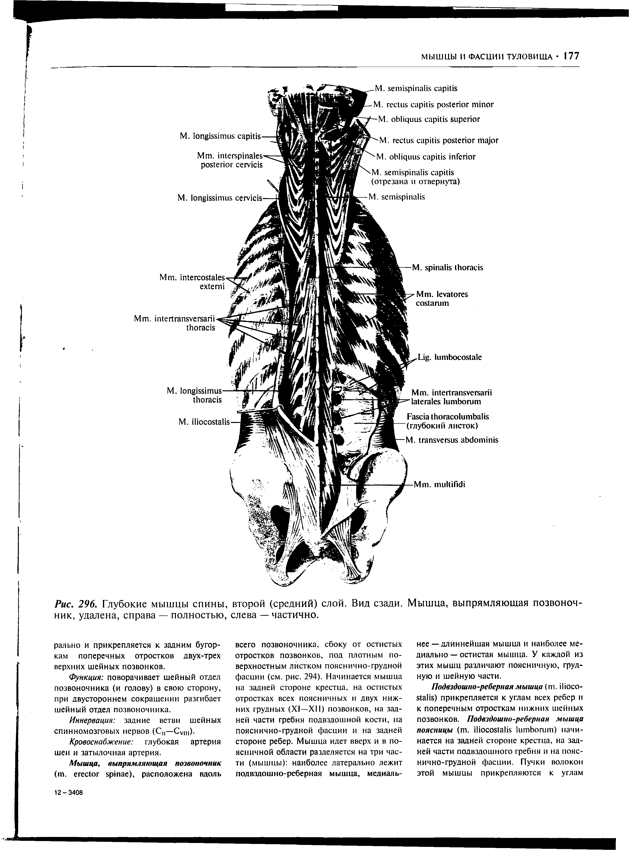 Рис. 296. Глубокие мышцы спины, второй (средний) слой. Вид сзади. Мышца, выпрямляющая позвоночник, удалена, справа — полностью, слева — частично.