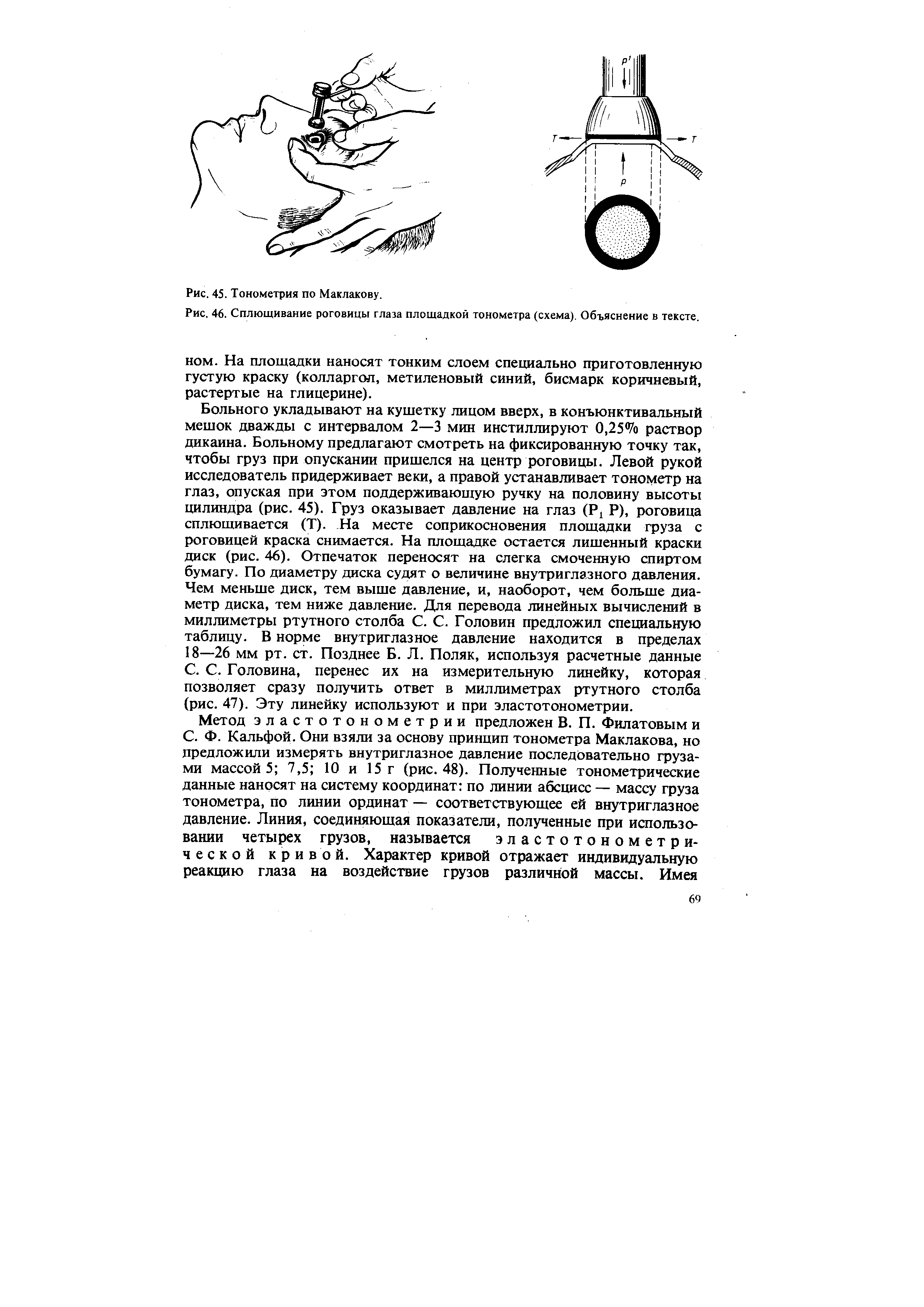 Рис. 46. Сплющивание роговицы глаза площадкой тонометра (схема). Объяснение в тексте.