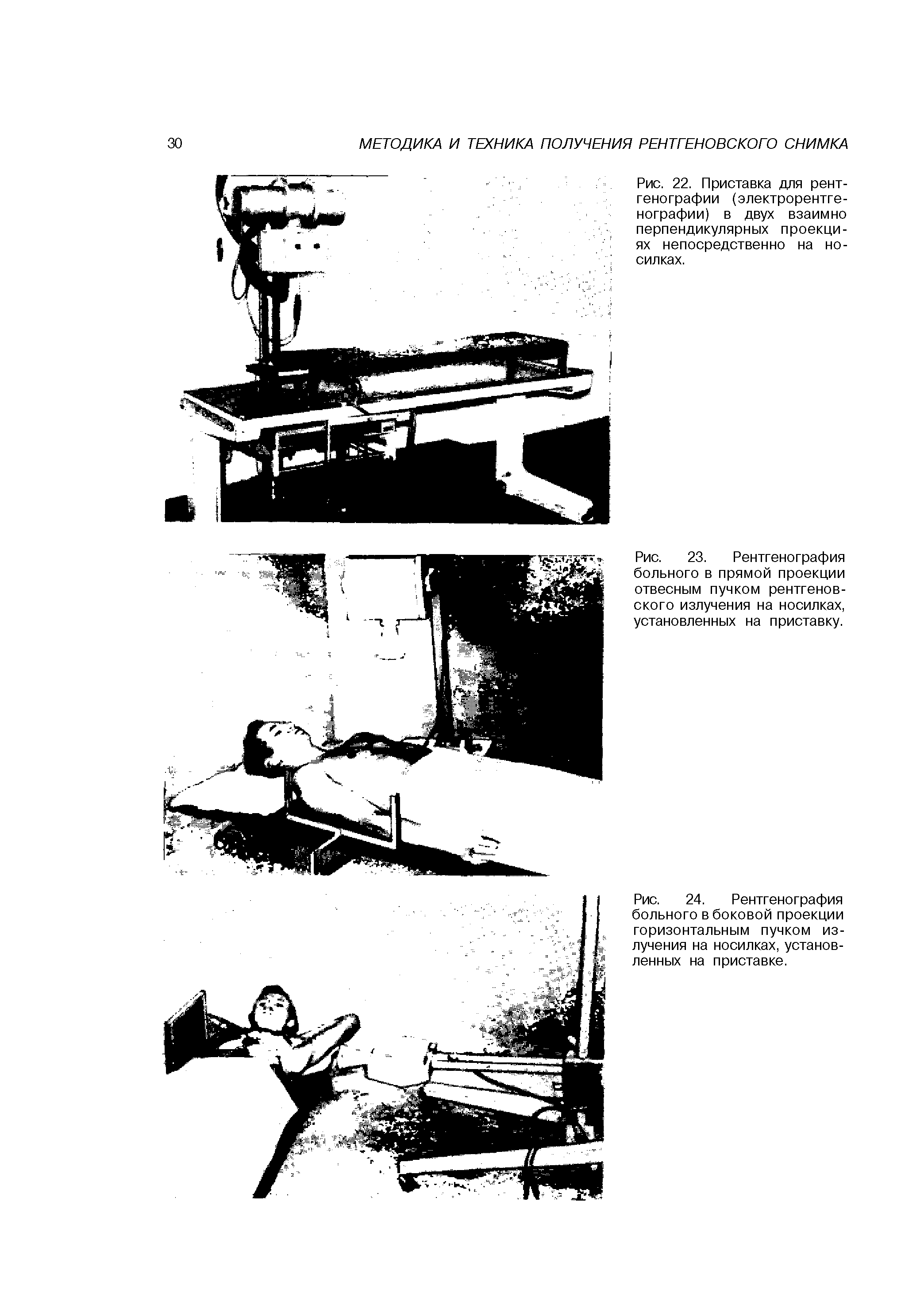 Рис. 24. Рентгенография больного в боковой проекции горизонтальным пучком излучения на носилках, установленных на приставке.