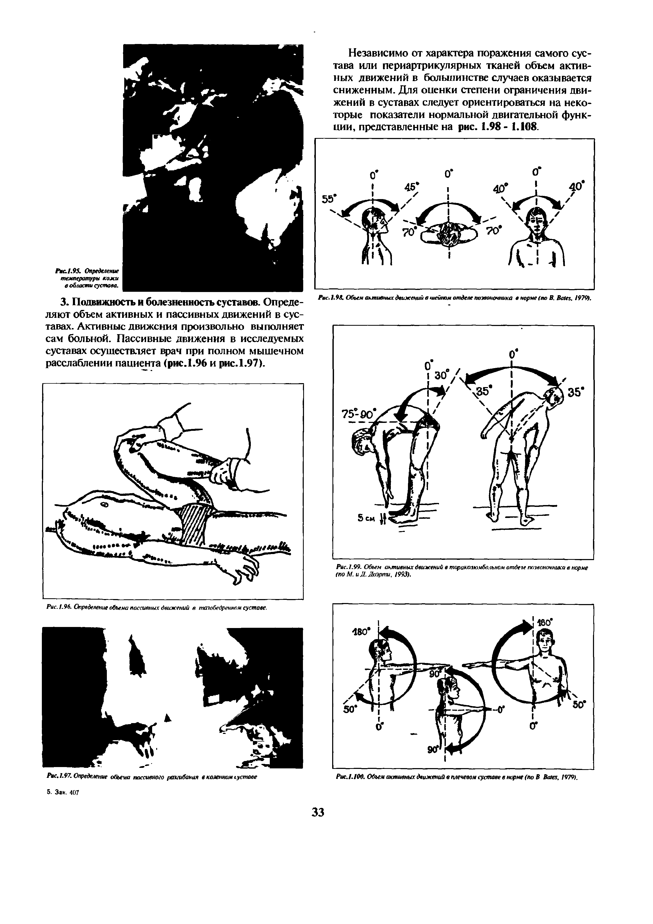 Рис. 1.96. Определение объема пассивных движений в тазобедренном суставе.