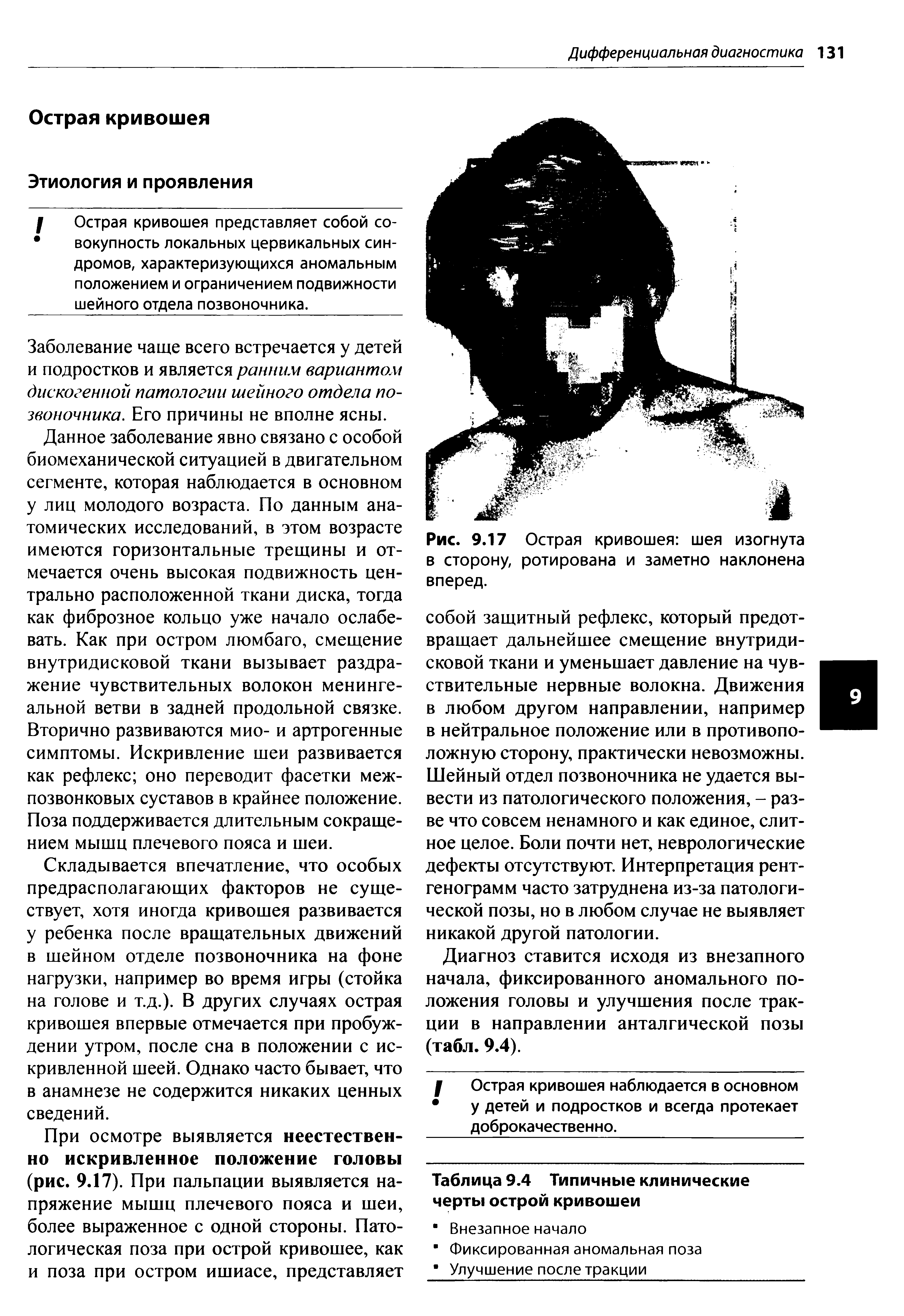 Рис. 9.17 Острая кривошея шея изогнута в сторону, ротирована и заметно наклонена вперед.