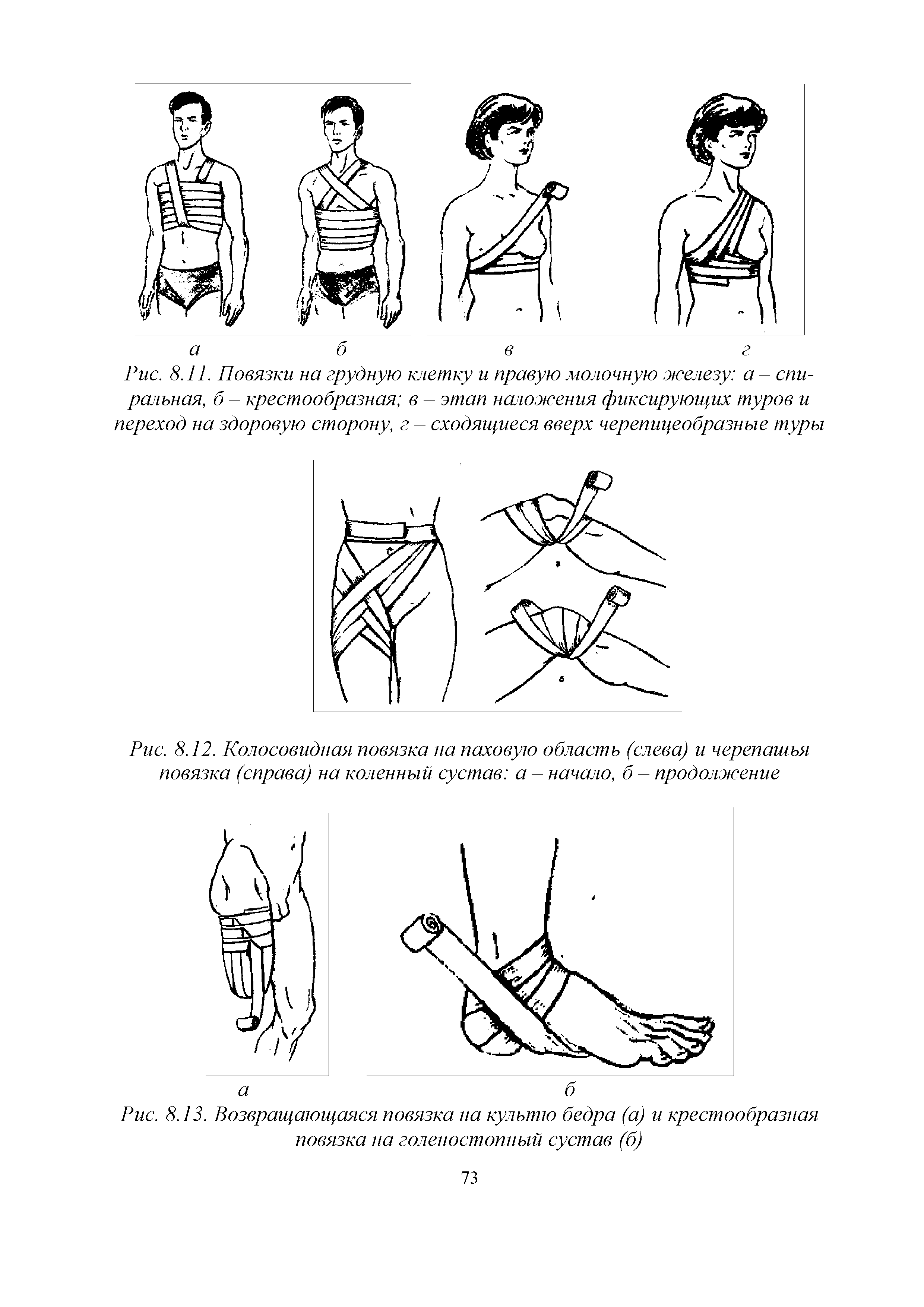 Рис. 8.12. Колосовидная повязка на паховую область (слева) и черепашья повязка (справа) на коленный сустав а - начало, б - продолжение...