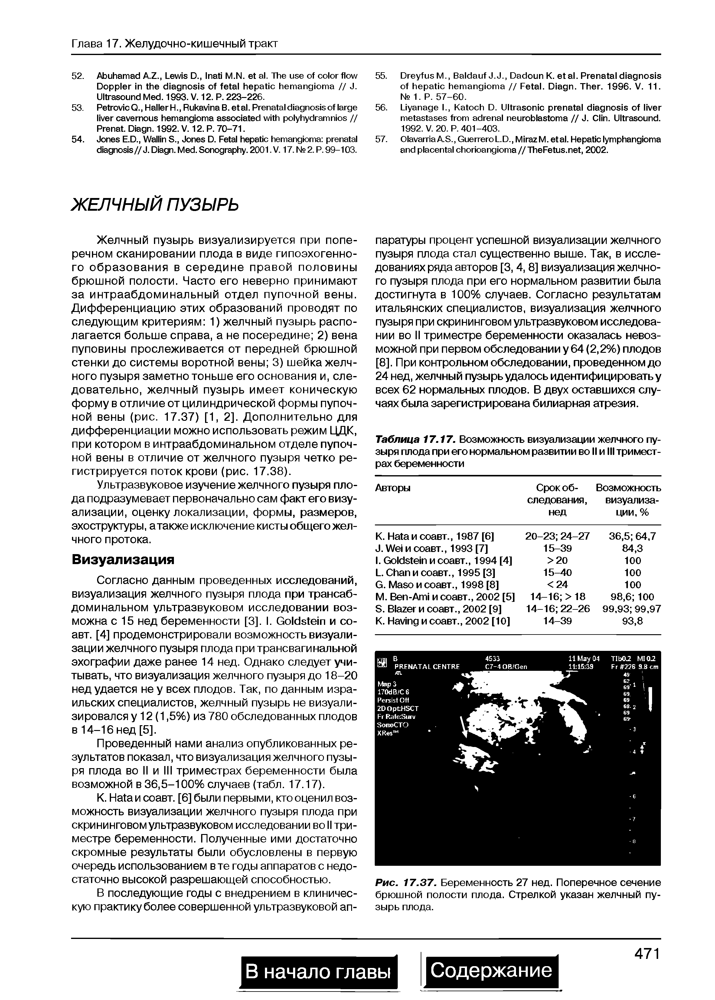 Таблица 17.17. Возможность визуализации желчного пузыря плода при его нормальном развитии во II и III триместрах беременности...