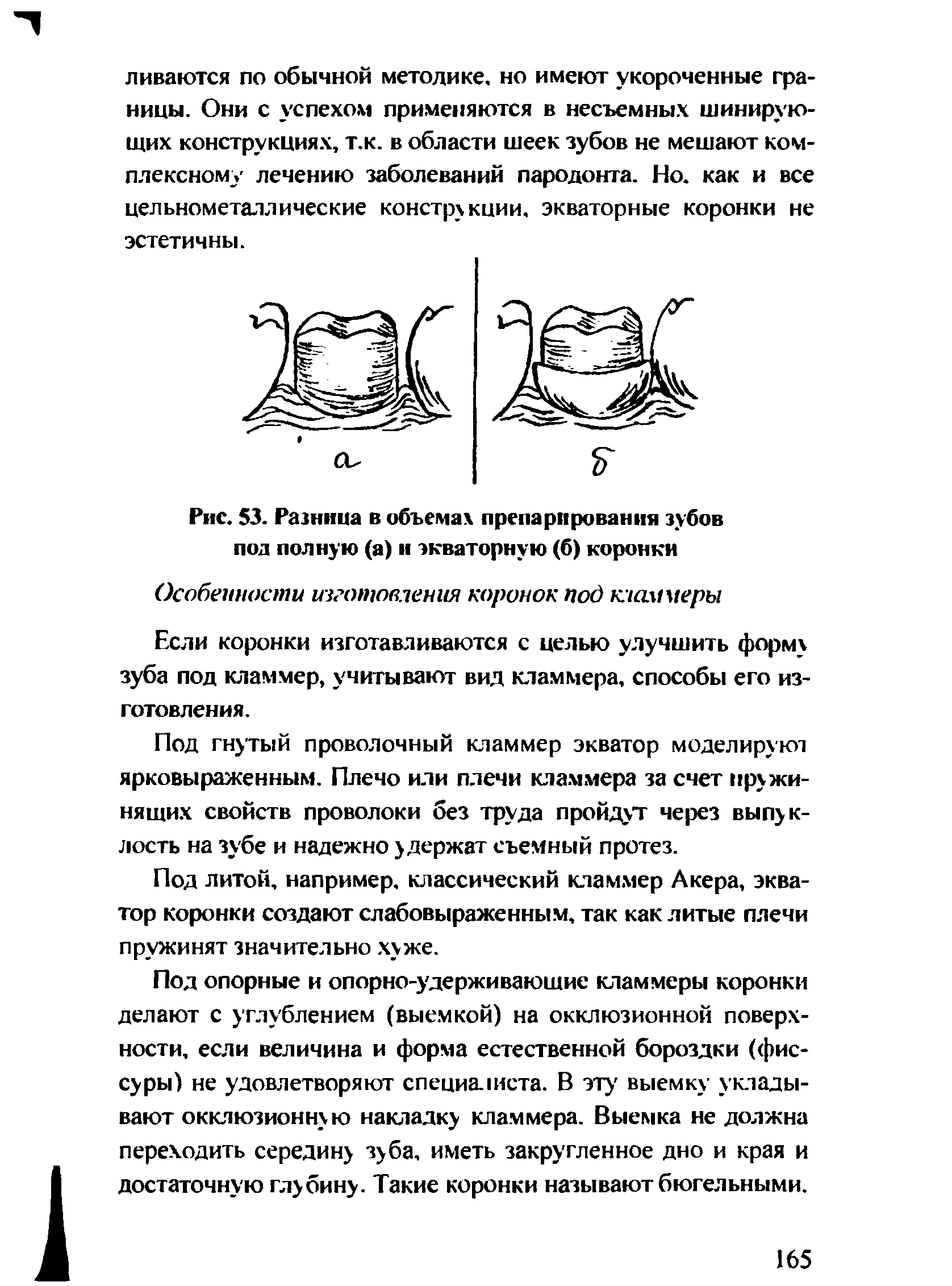 Рис. 53. Разница в объемах препарирования зубов пол полную (а) и экваторную (б) коронки...