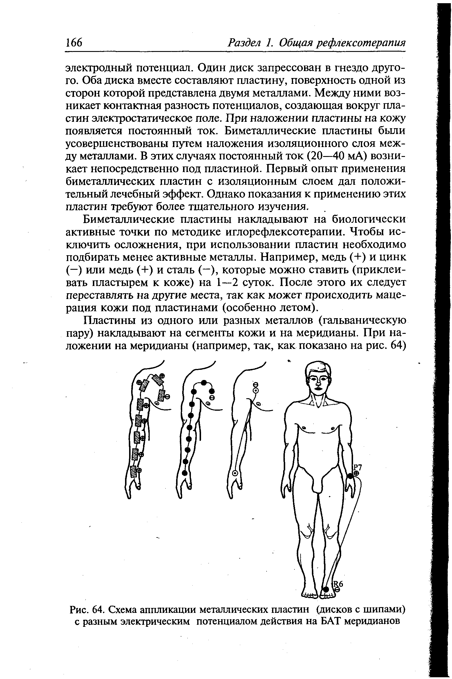 Рис. 64. Схема аппликации металлических пластин (дисков с шипами) с разным электрическим потенциалом действия на БАТ меридианов...