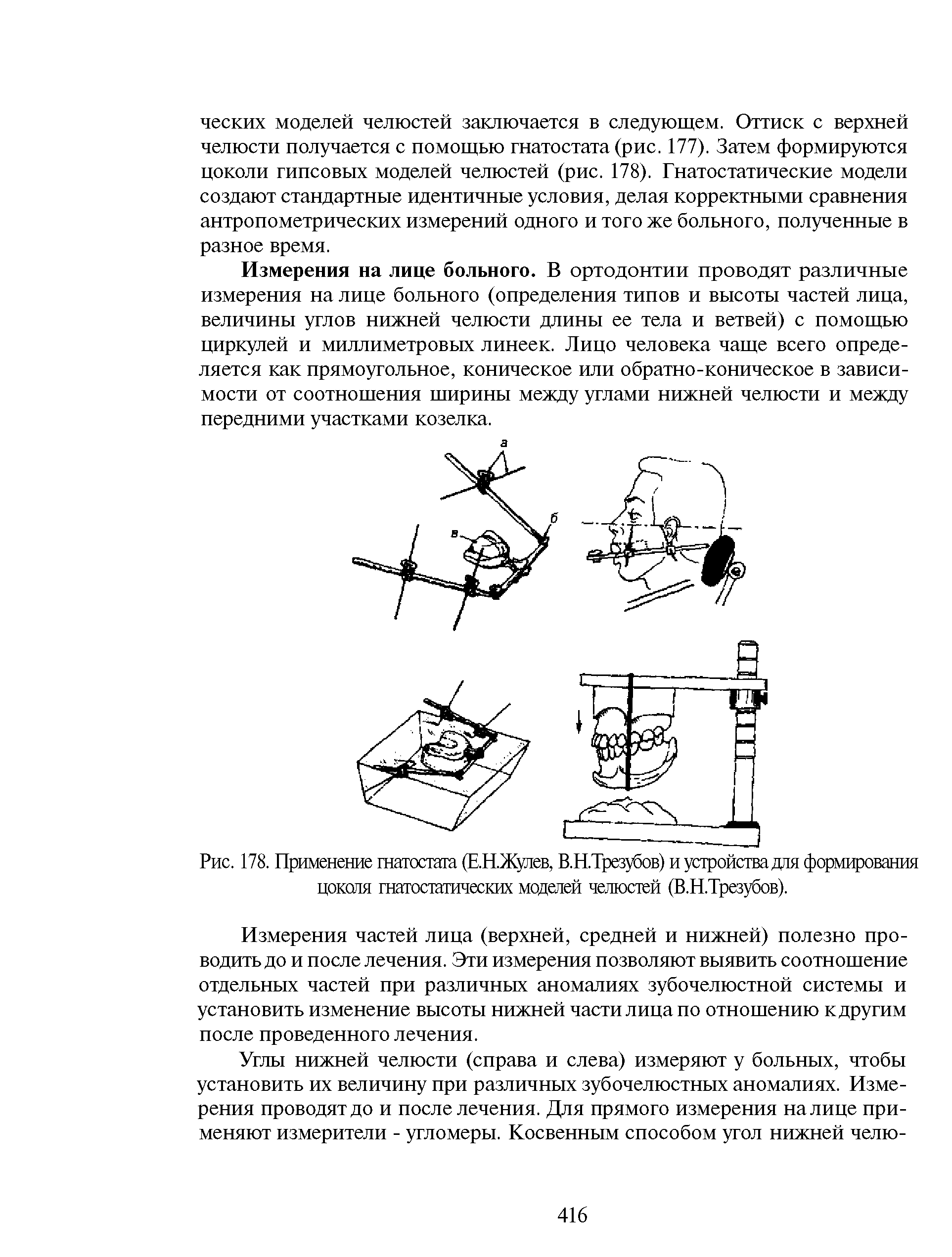 Рис. 178. Применение гнатостата (ЕНЖутев, В.НТрезубов) и устройства доя формирования цокспя гнатостатических моделей челюстей (В.Н.Трезубов).