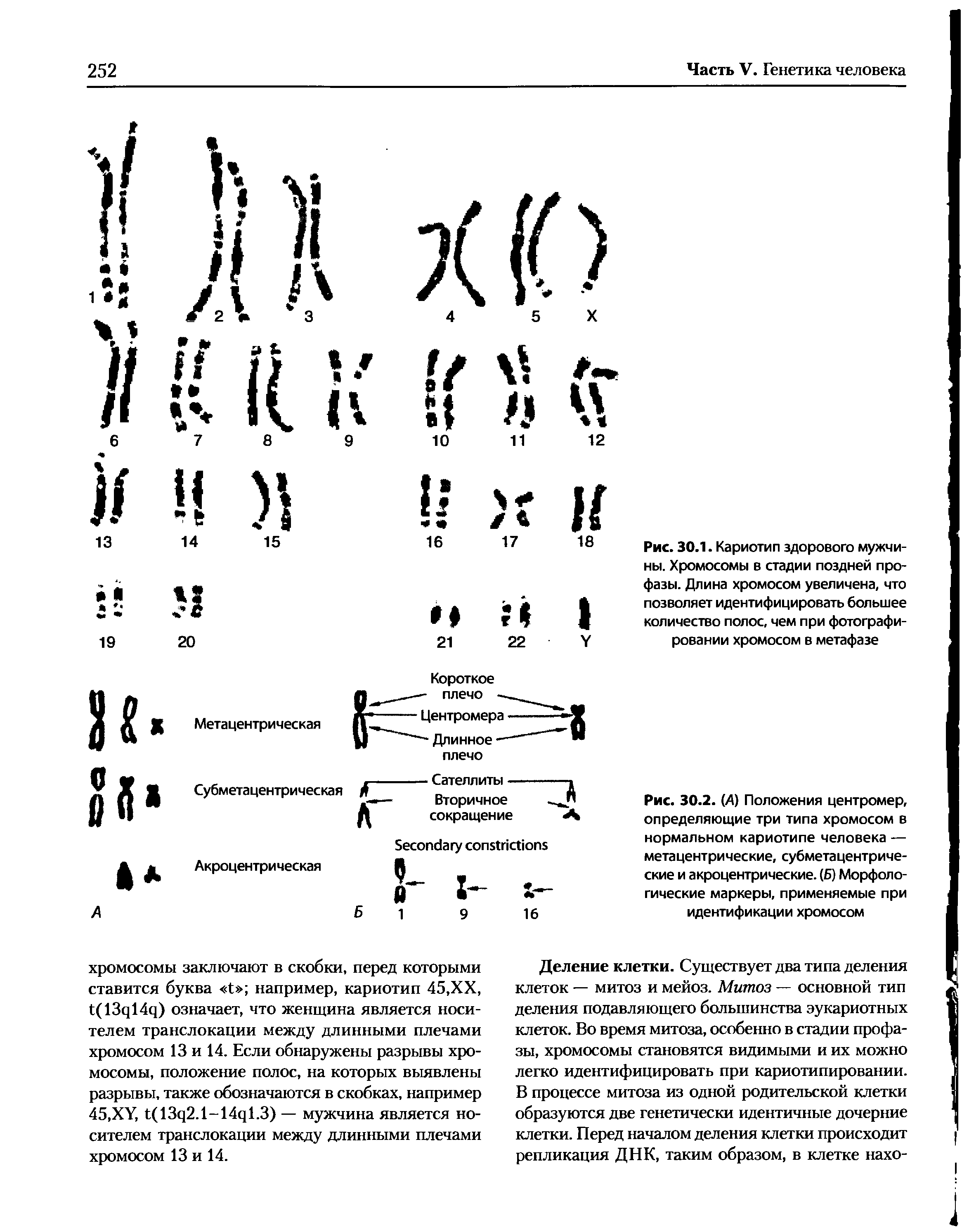 Рис. 30.2. (А) Положения центромер, определяющие три типа хромосом в нормальном кариотипе человека — метацентрические, субметацентрические и акроцентрические. (Б) Морфологические маркеры, применяемые при идентификации хромосом...