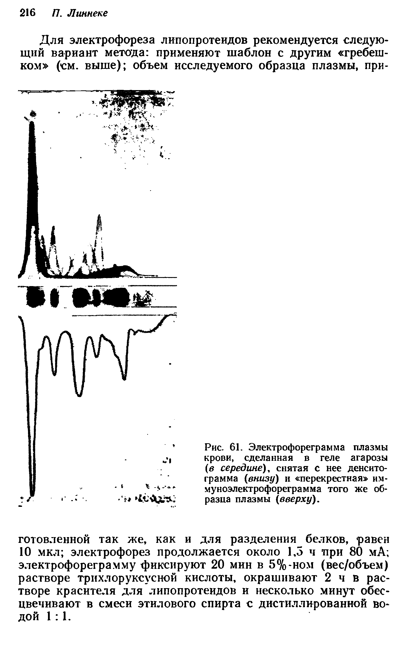 Рис. 61. Электрофореграмма плазмы крови, сделанная в геле агарозы (в середине), снятая с нее денситограмма (внизу) и перекрестная иммуноэлектрофореграмма того же образца плазмы (вверху).