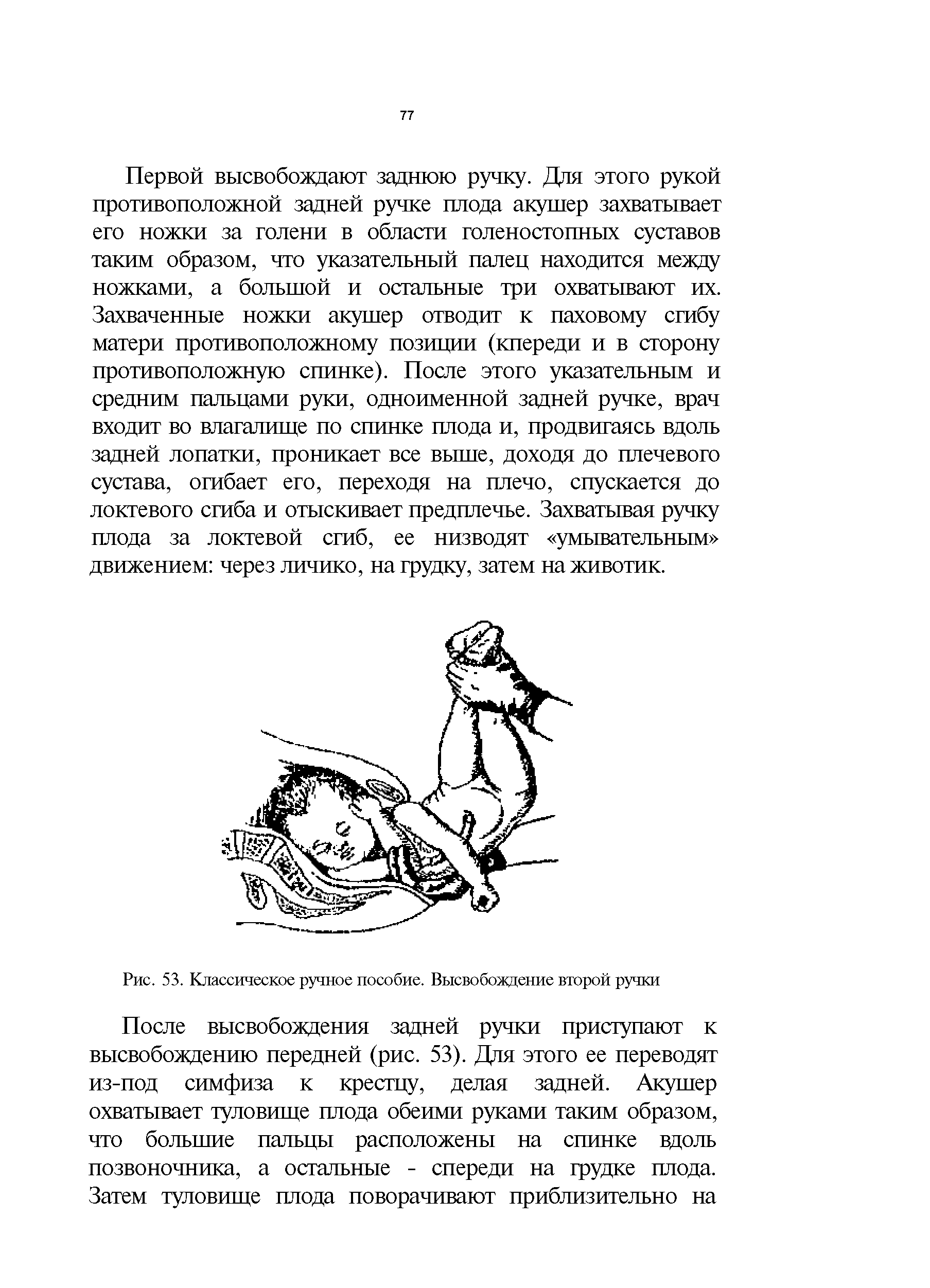 Рис. 53. Классическое ручное пособие. Высвобождение второй ручки...