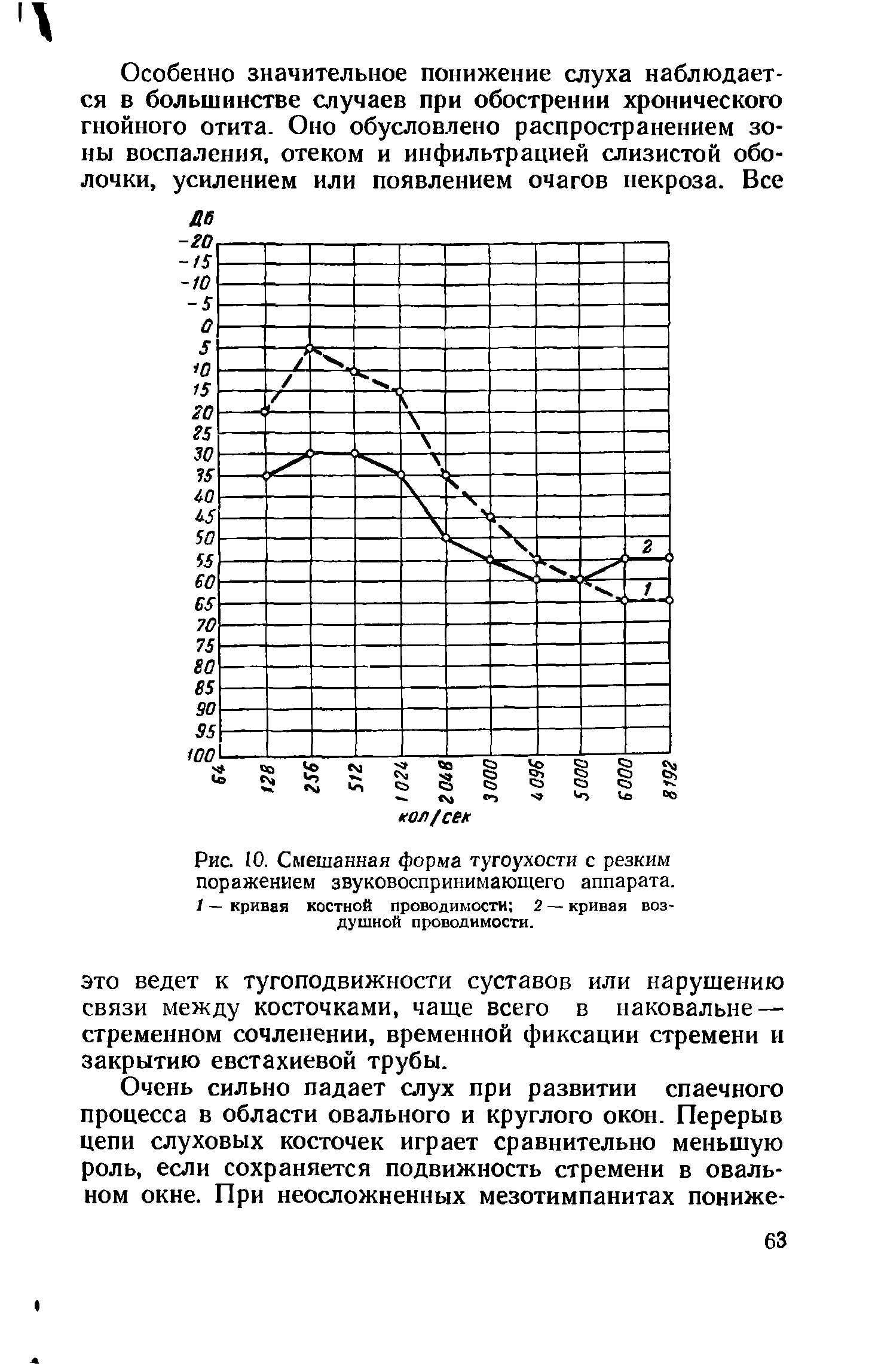 Рис. 10. Смешанная форма тугоухости с резким поражением звуковоспринимающего аппарата. 1 — кривая костной проводимости 2 — кривая воздушной проводимости.