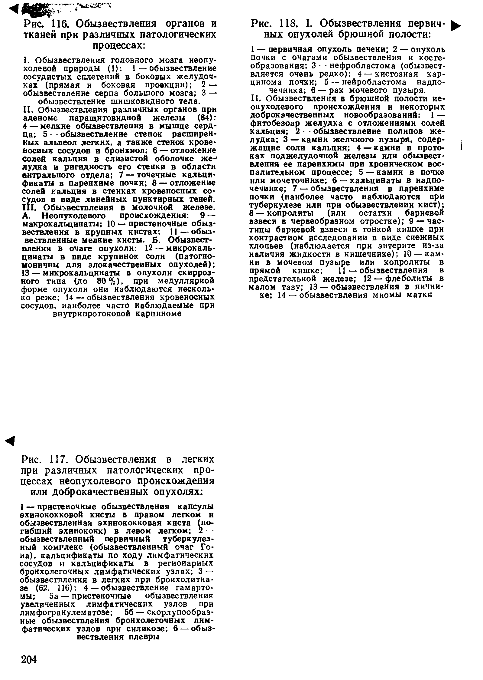 Рис. 117. Обызвествления в легких при различных патологических процессах неопухолевого происхождения или доброкачественных опухолях ...