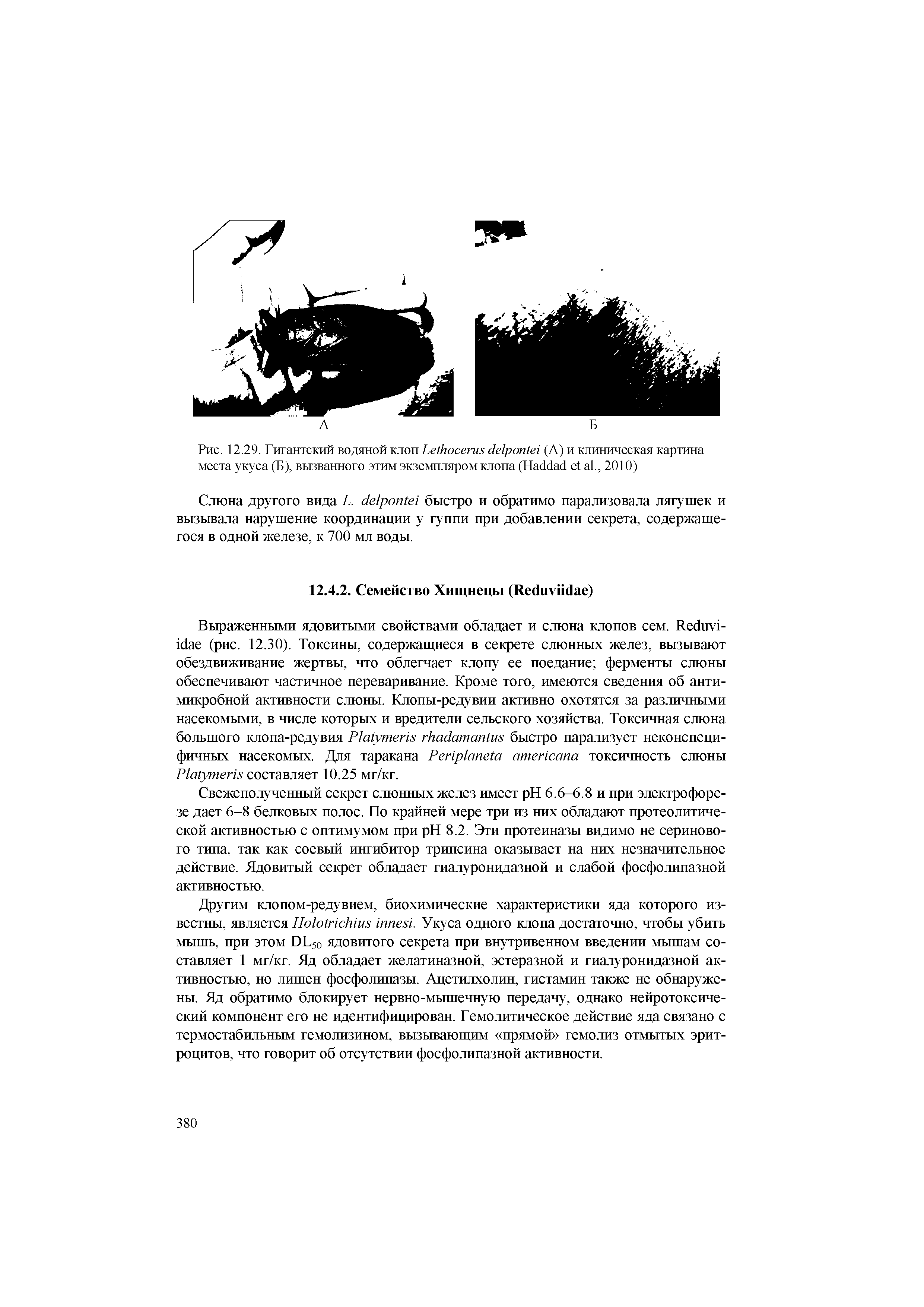 Рис. 12.29. Гигантский водяной клоп L (А) и клиническая картина места укуса (Б), вызванного этим экземпляром клопа (H ., 2010)...