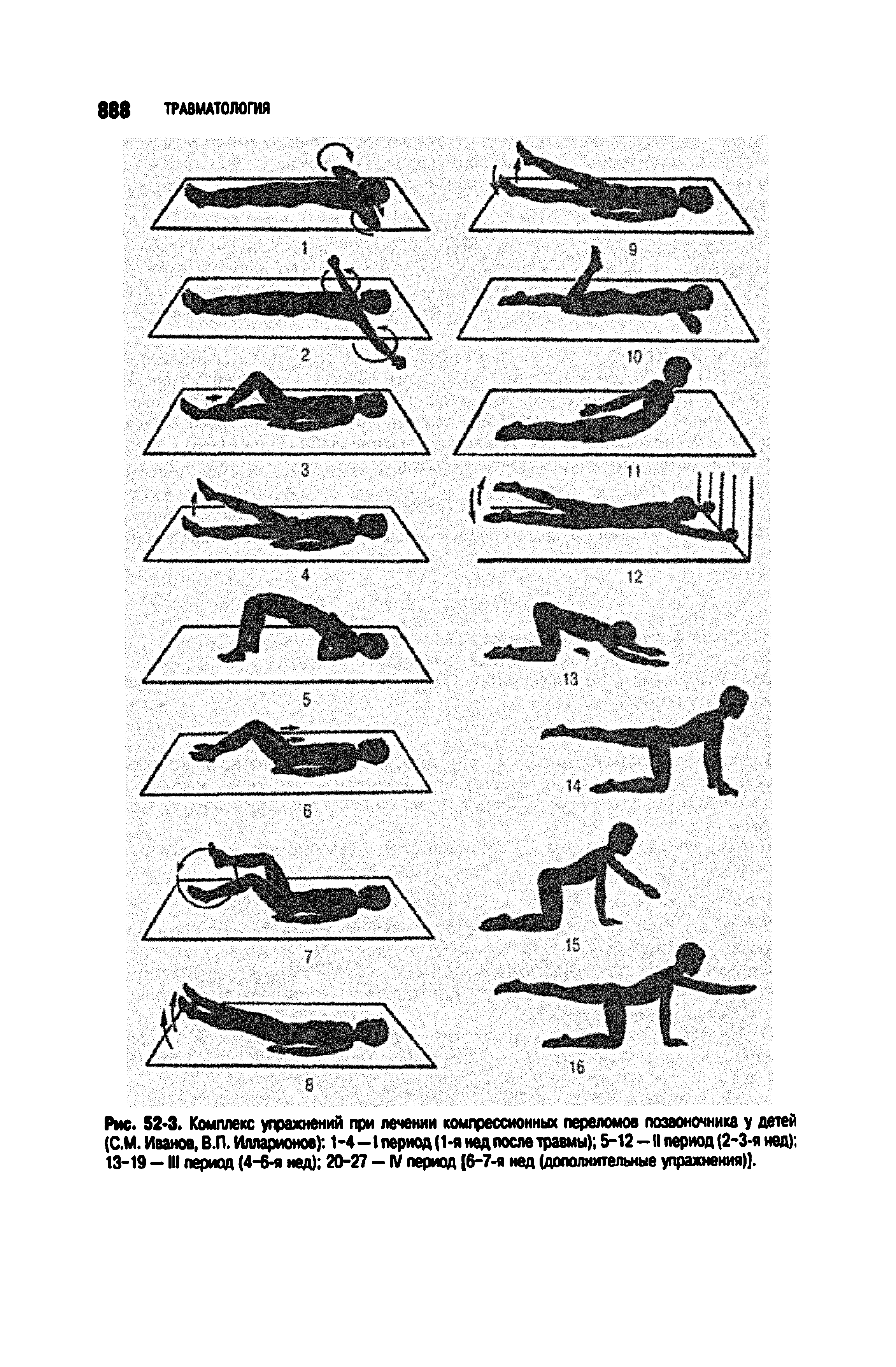 Рис. 52 3. Комплекс упражнений при лечении компрессионных переломов позвоночника у детей (С.М. Иванов, В.П. Илларионов) 1-4-1 период (1-я нед после травмы) 5-12 -II период (2-3-я нед) 13-19 - III период (4-6-я нед) 20-27 - П/ период [6-7-я нед (дополнительные упражнения)].