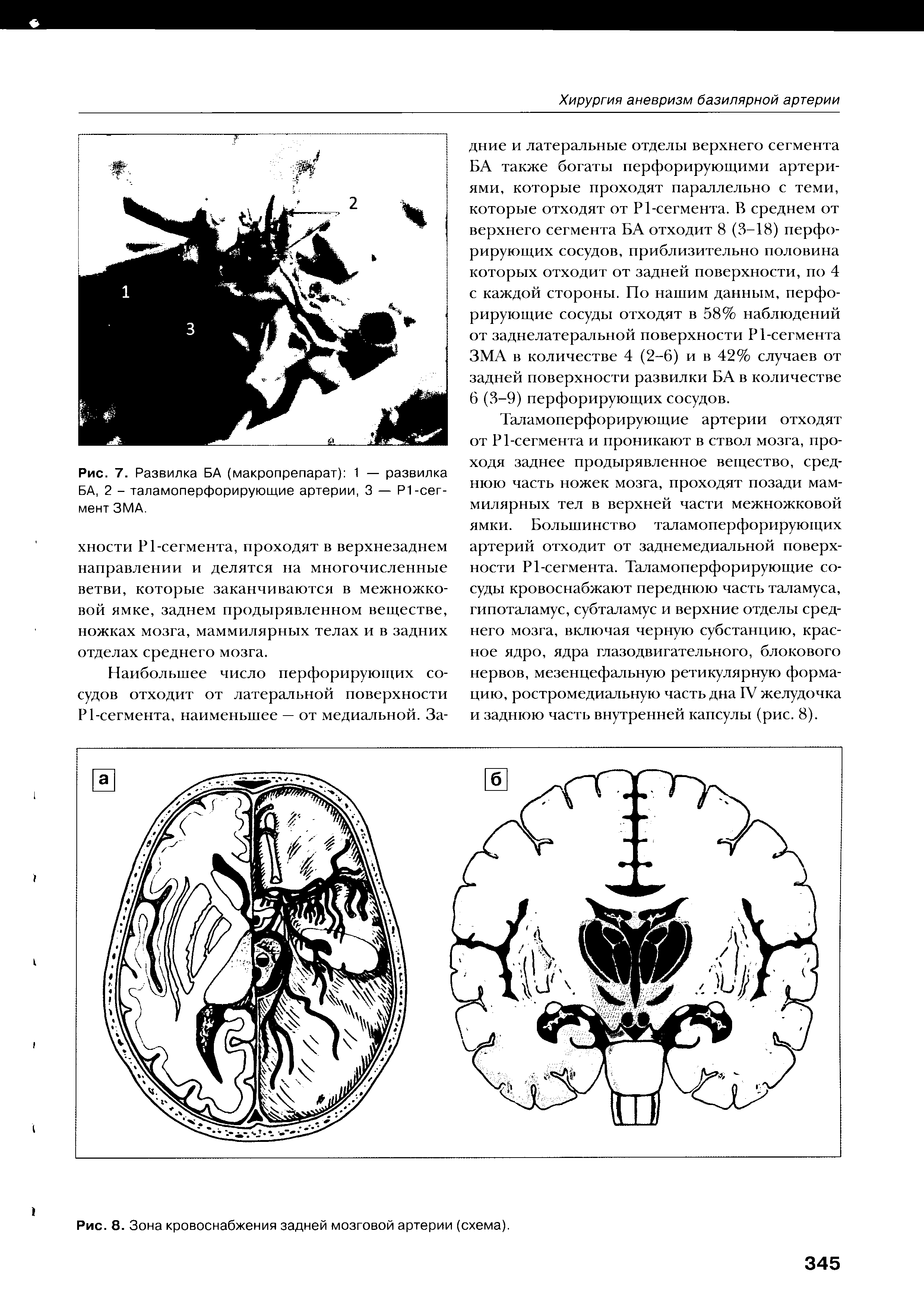 Рис. 8. Зона кровоснабжения задней мозговой артерии (схема).