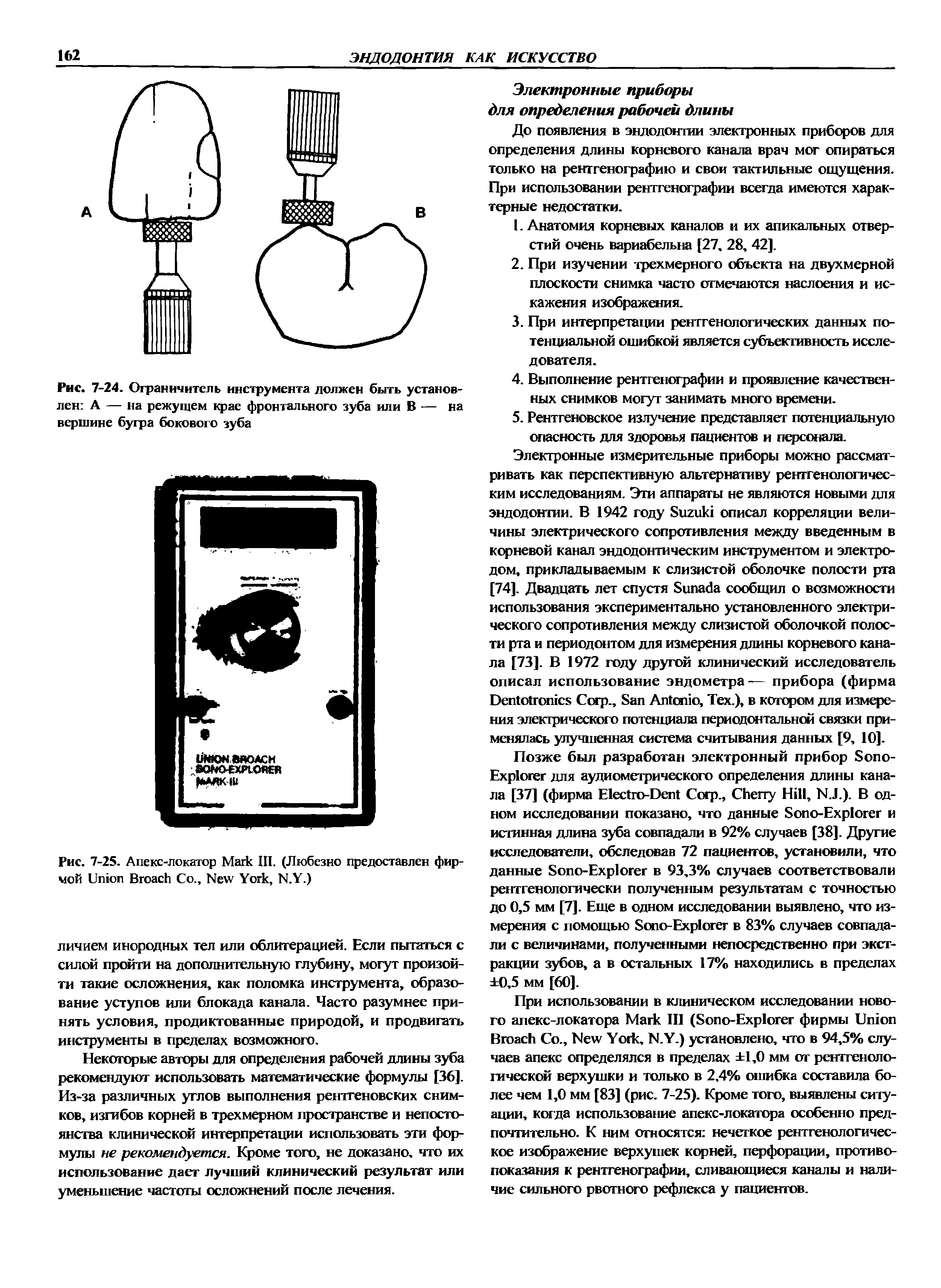 Рис. 7-25. Апекс-локатор M III. (Любезно предоставлен фирмой U B Со., N Y , N.Y.)...