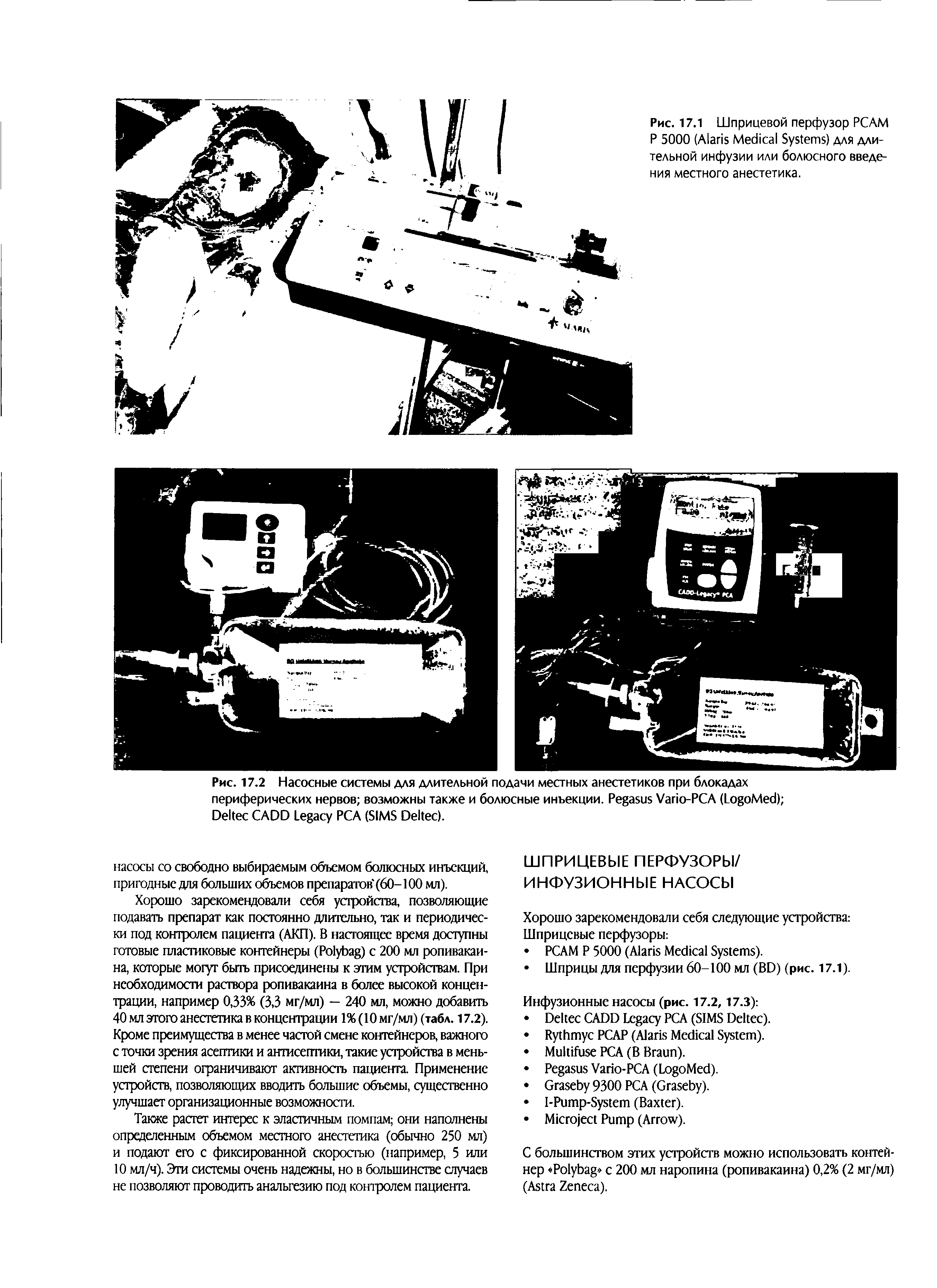 Рис. 17.2 Насосные системы для длительной подачи местных анестетиков при блокадах периферических нервов возможны также и болюсные инъекции. P V -PCA (L M ) D CADD L PCA (SIMS D ).