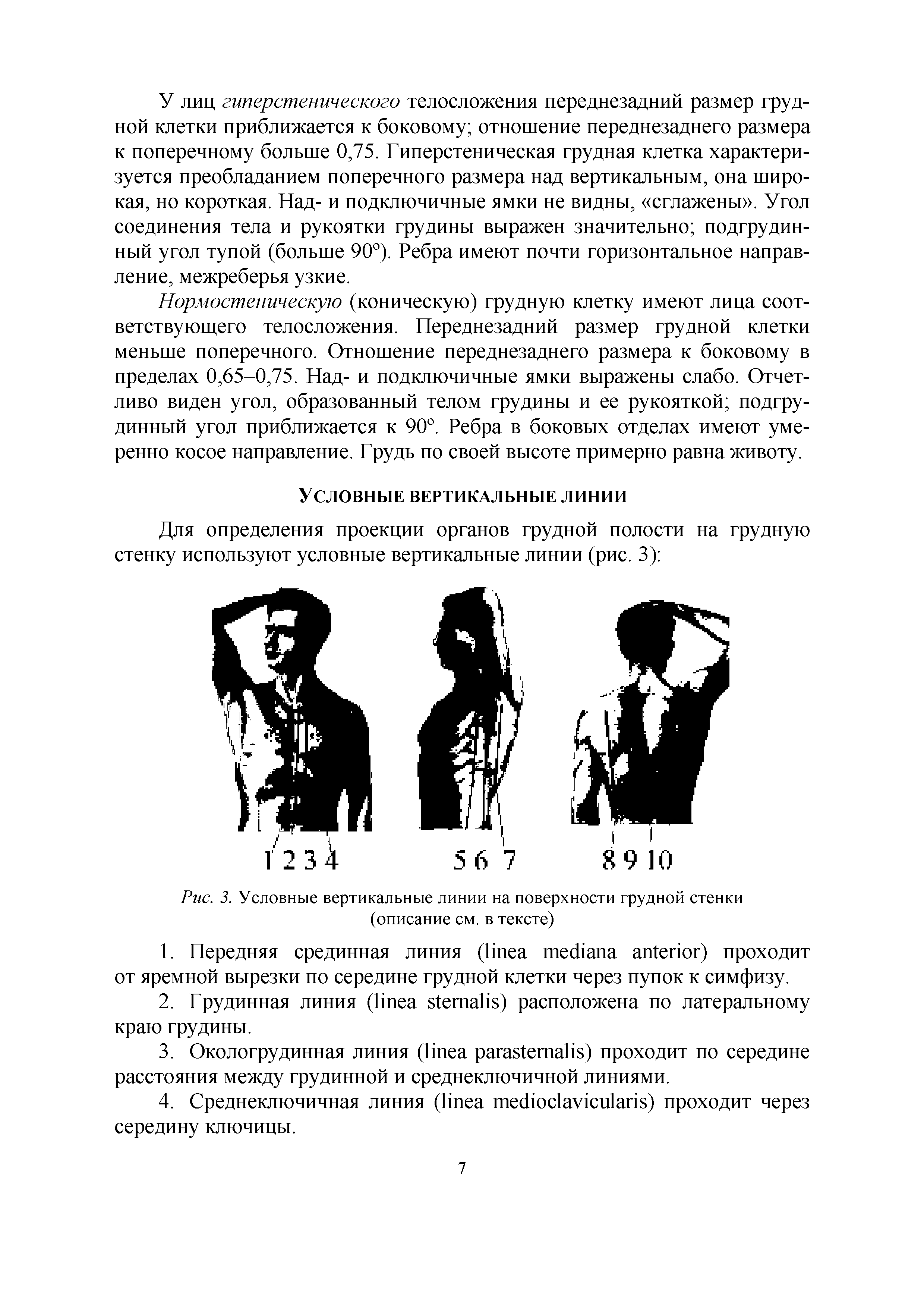 Рис. 3. Условные вертикальные линии на поверхности грудной стенки (описание см. в тексте)...