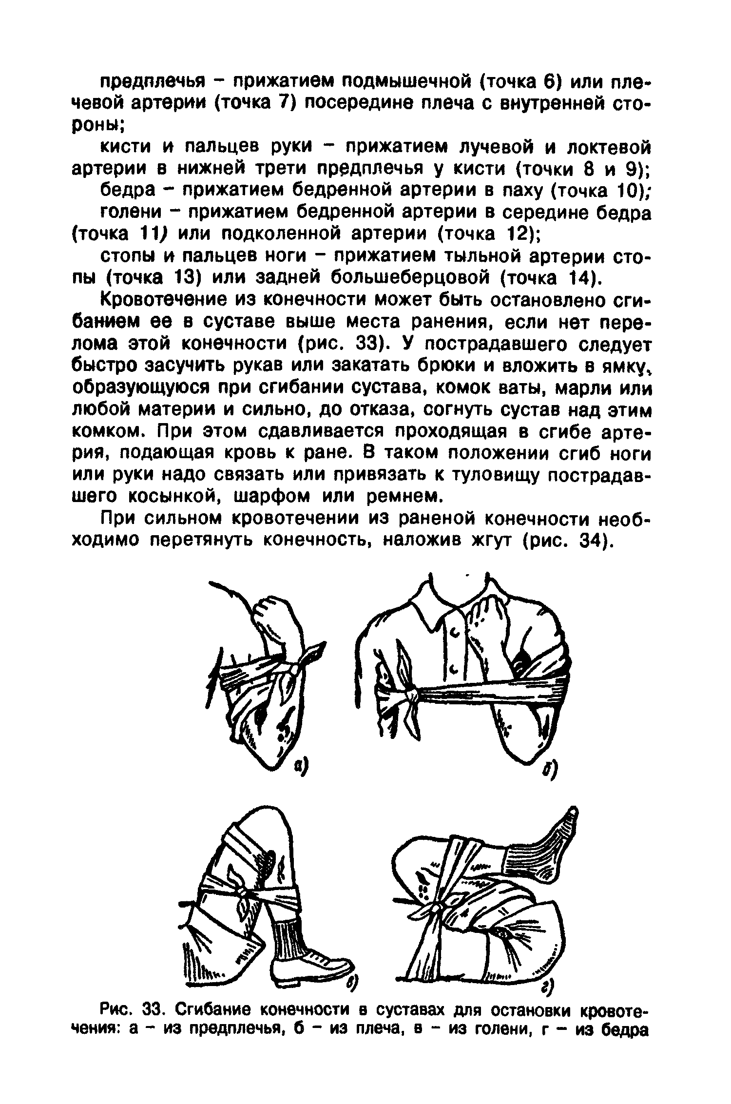 Рис. 33. Сгибание конечности в суставах для остановки кровотечения а - из предплечья, б - из плеча, в - из голени, г - из бедра...