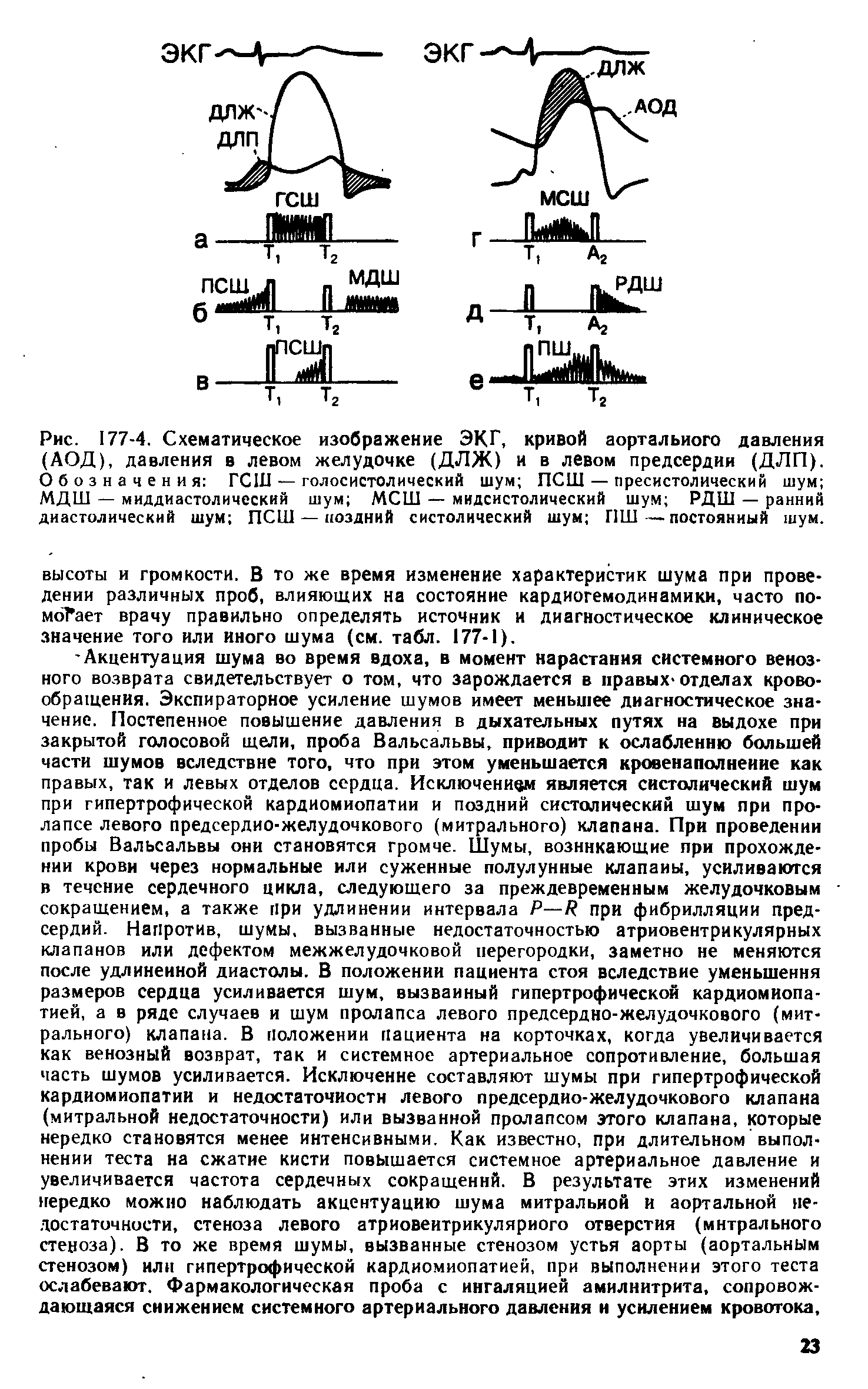 Рис. 177-4. Схематическое изображение ЭКГ, кривой аортального давления (АОД), давления в левом желудочке (ДЛЖ) и в левом предсердии (ДЛП). Обозначения ГСШ — голосистолический шум ПСШ — пресистолический шум МДШ — миддиастолический шум МСШ — мидсистолический шум РДШ — ранний диастолический шум ПСШ — поздний систолический шум Г1Ш—постоянный шум.